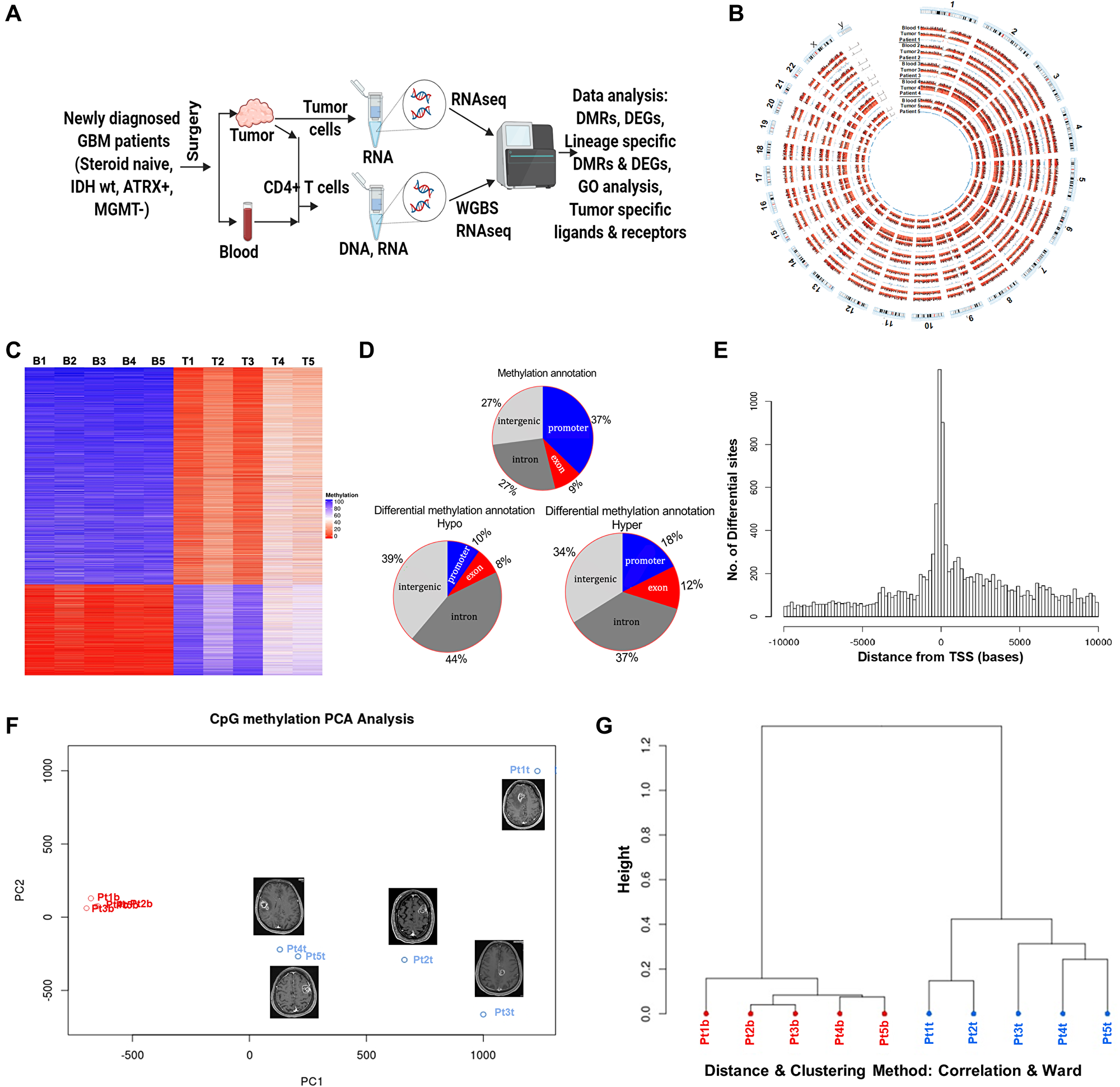 DNA methylome analysis of tumor infiltrating and peripheral blood CD4+ T cells from GBM Patients