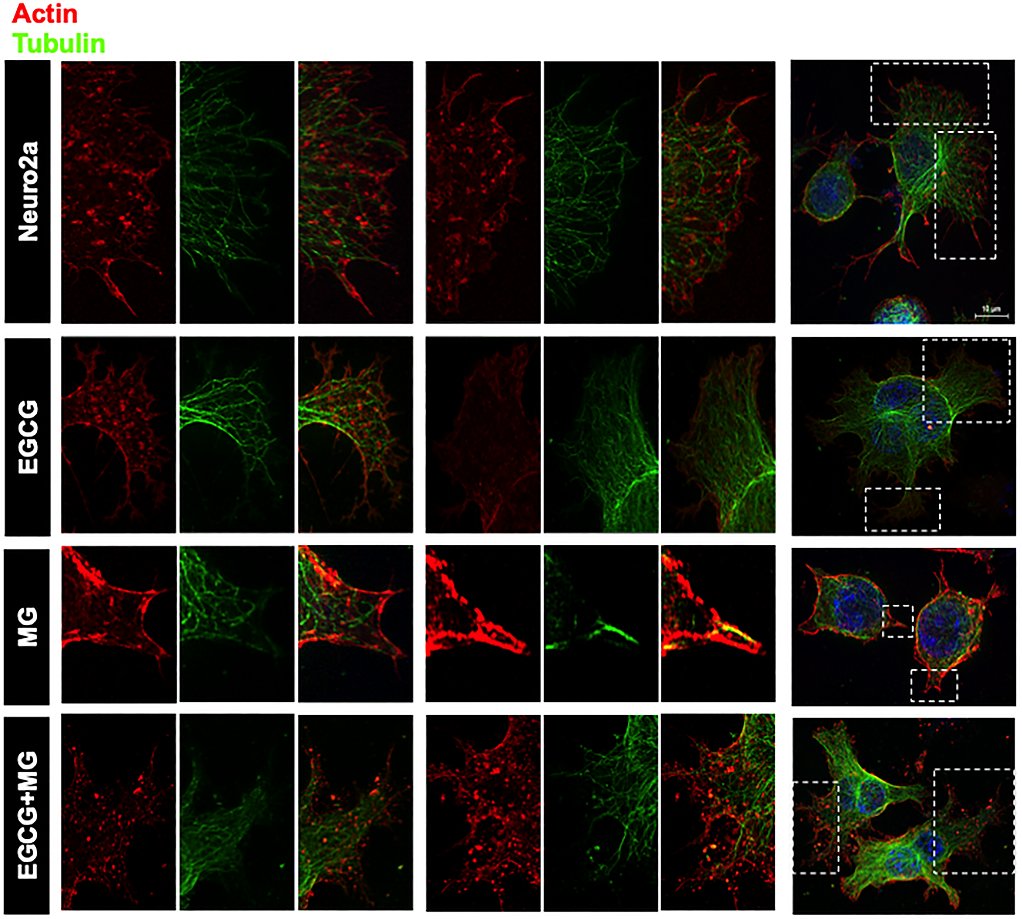 Super-resolution microscopy images for detailed analysis of cytoskeleton