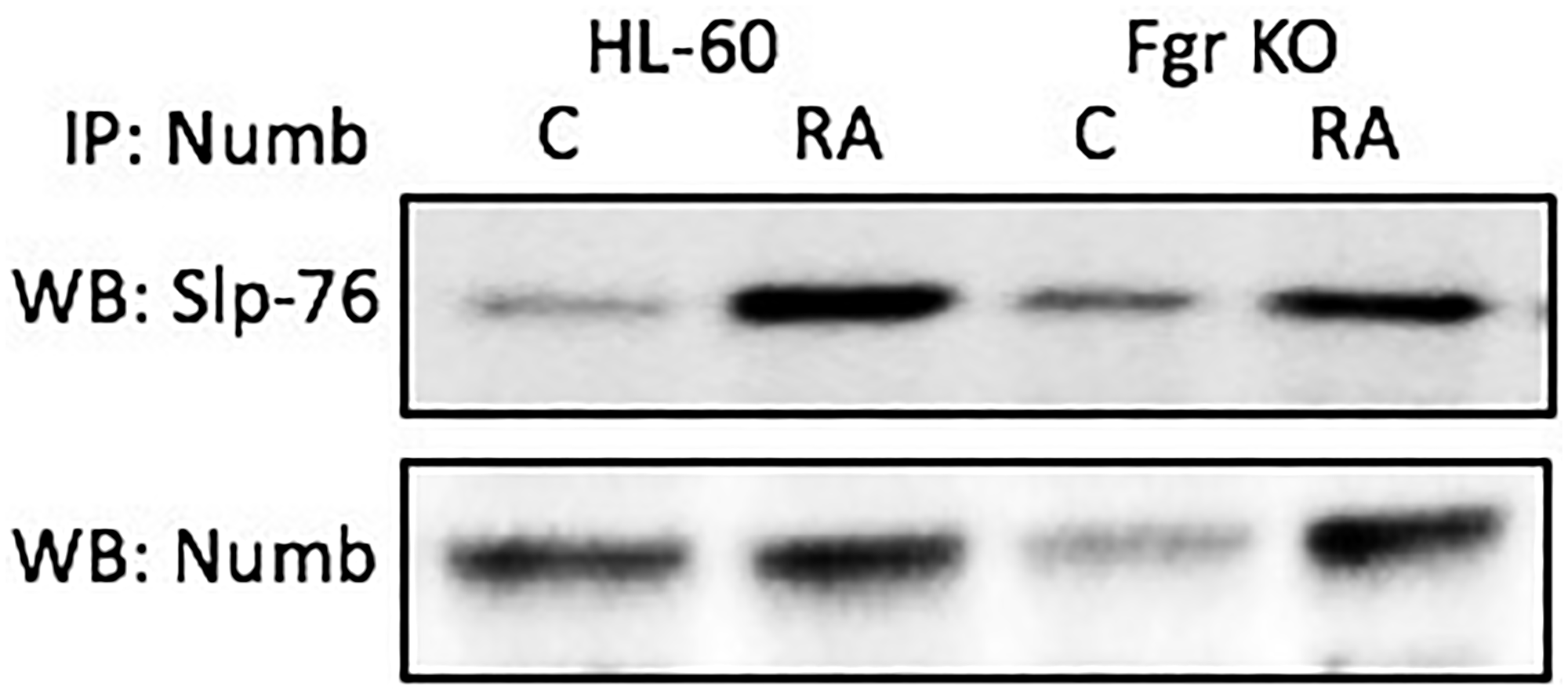 Numb binding Slp-76 in HL-60 wt and Fgr KO cells assayed by immunoprecipitation