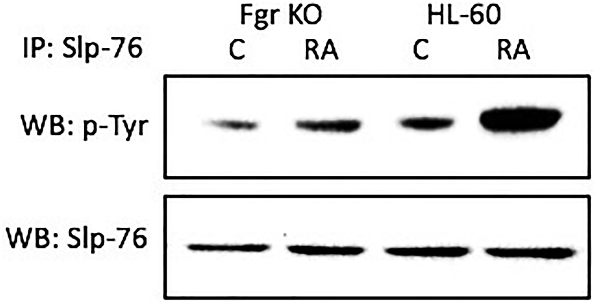 Slp-76 tyrosine phosphorylation in HL-60 wt and Fgr KO cells assessed by immunoprecipitation