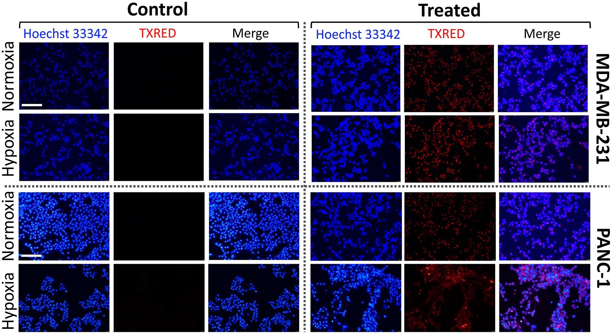 Drug uptake efficiency in normoxic and hypoxic conditions