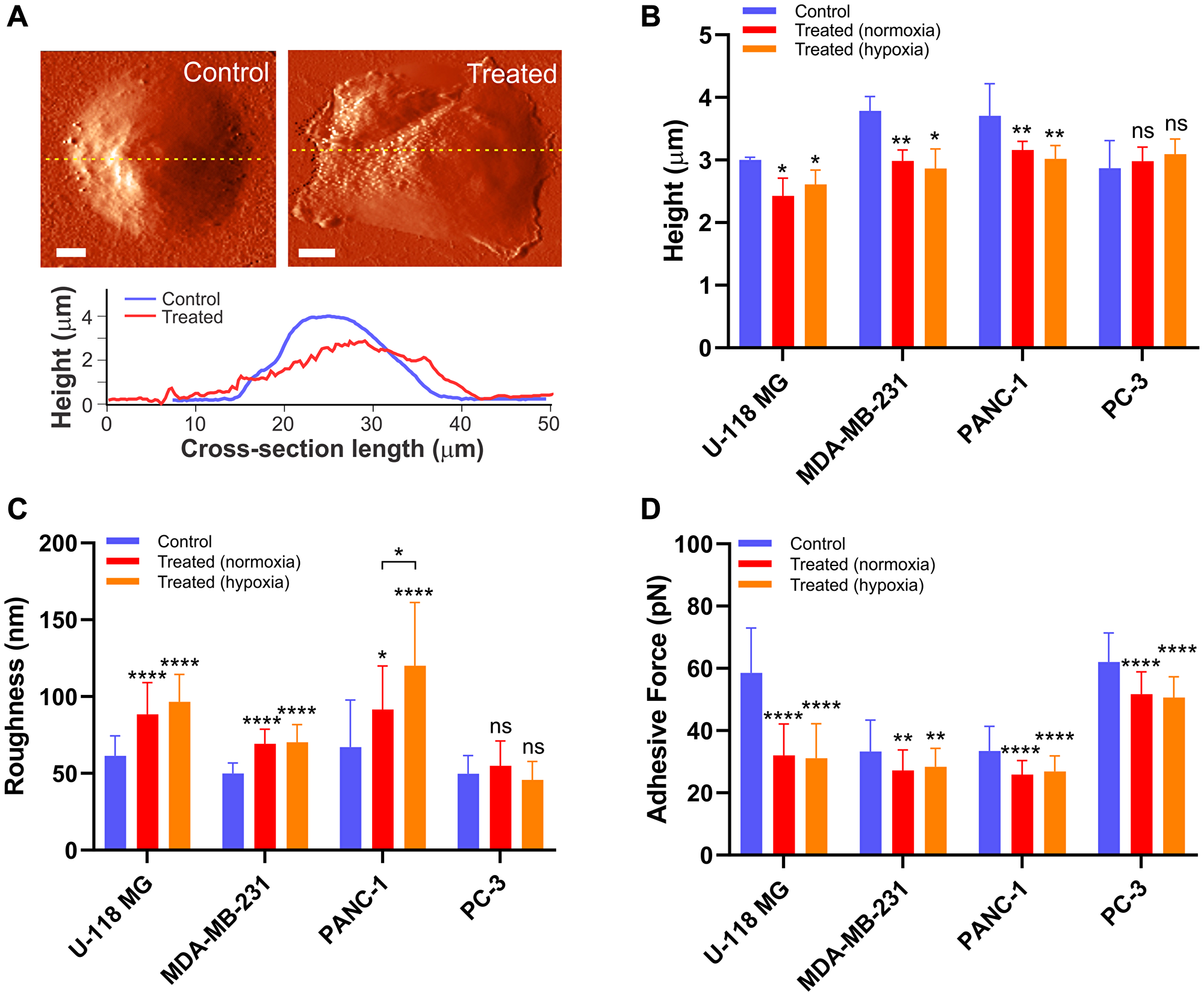 The drug-induced morphological alteration in cancer cells