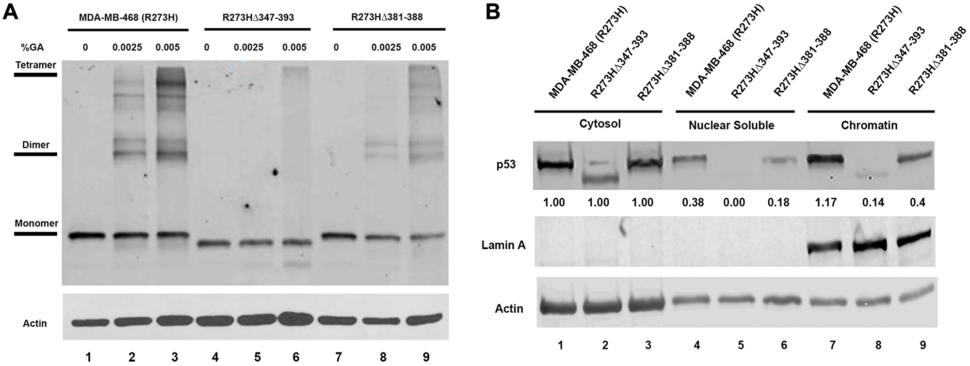 Mutations in the OD of mtp53 destabilize tetramer formation and reduce mtp53 chromatin association