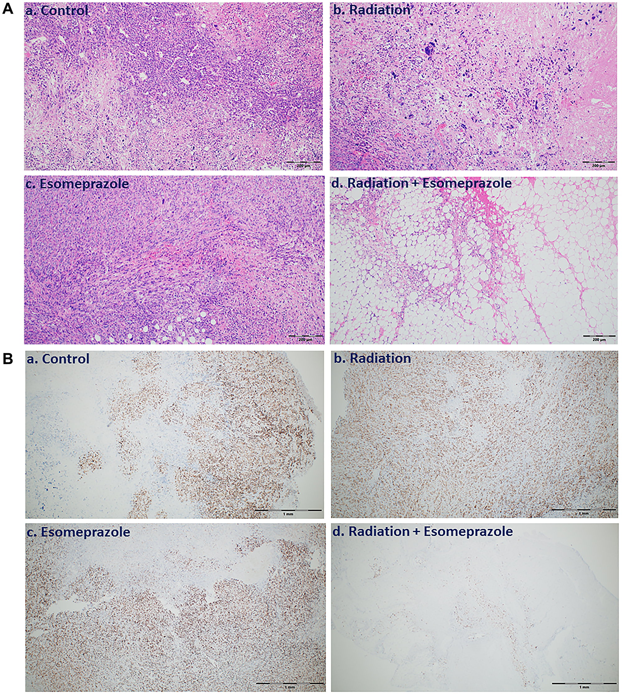Combination of esomeprazole and radiation reduces cancer cell growth and proliferation