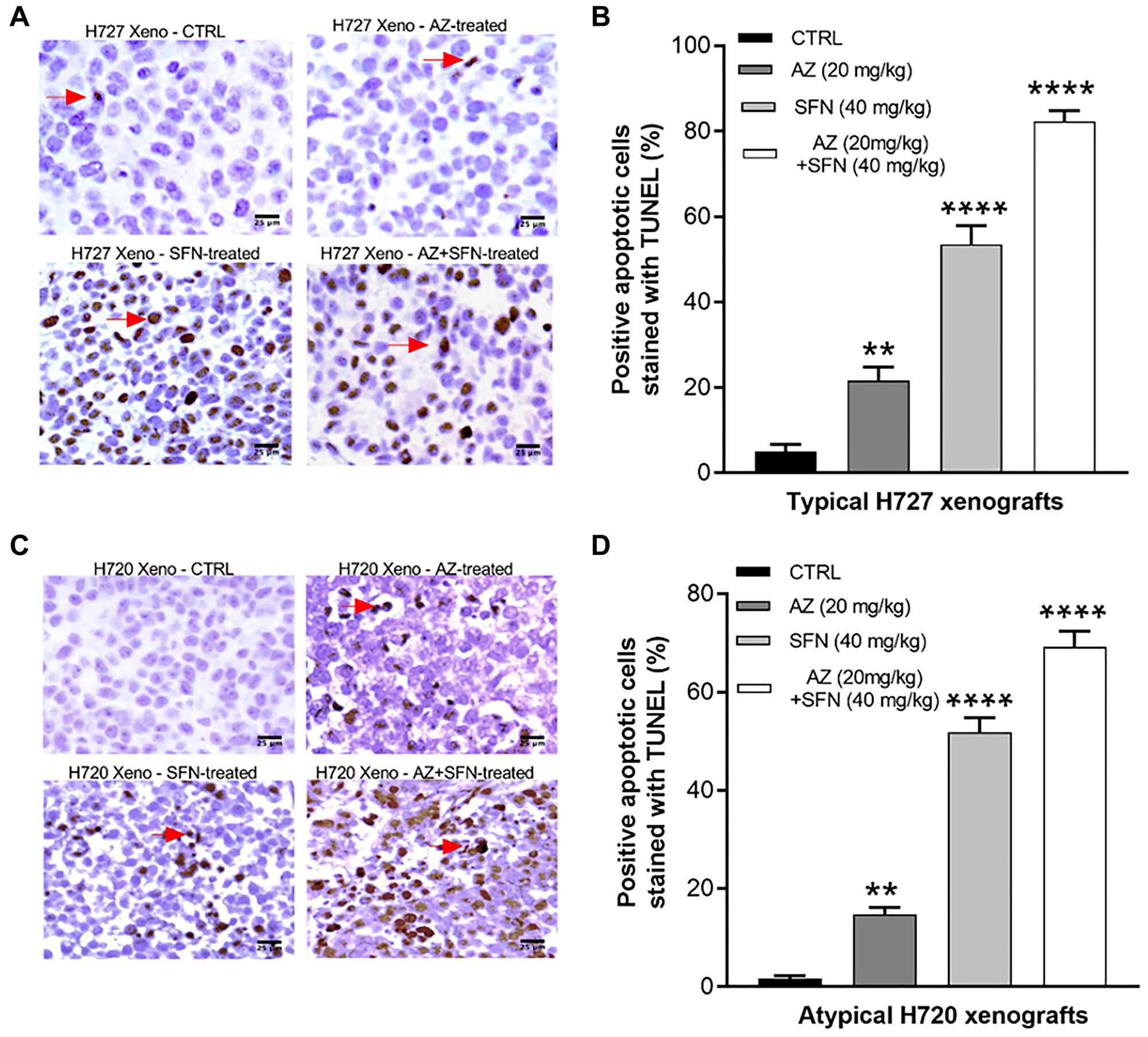 AZ, SFN, and AZ+SFN induce in vivo TUNEL apoptosis in BC xenografts