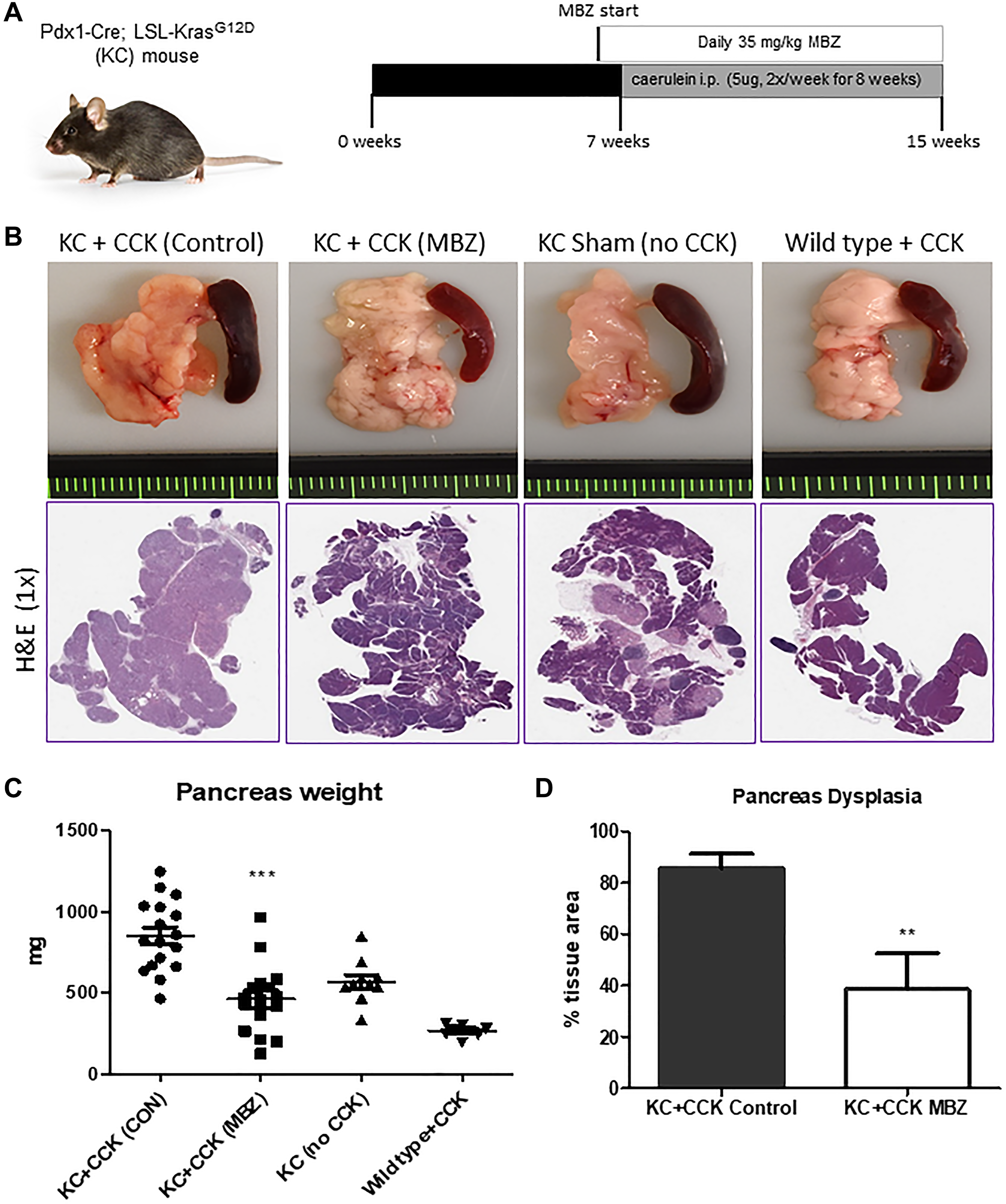 Mebendazole suppressed Kras-mediated, cearulein-induced tumorigenesis in the KC mouse model of pancreatitis