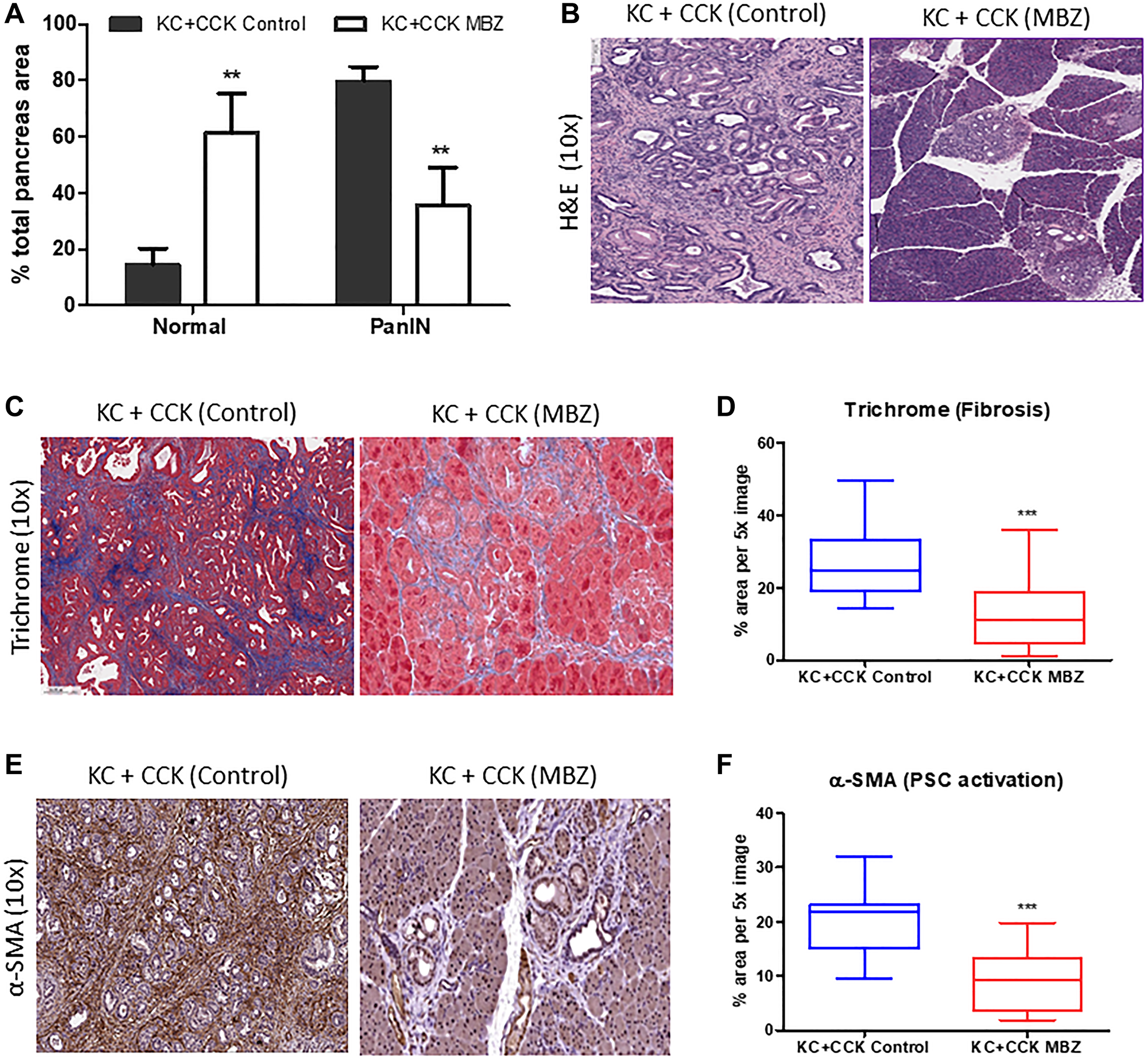 Mebendazole inhibited PanIN formation and stromal desmoplasia under conditions of inflammatory pancreatitis