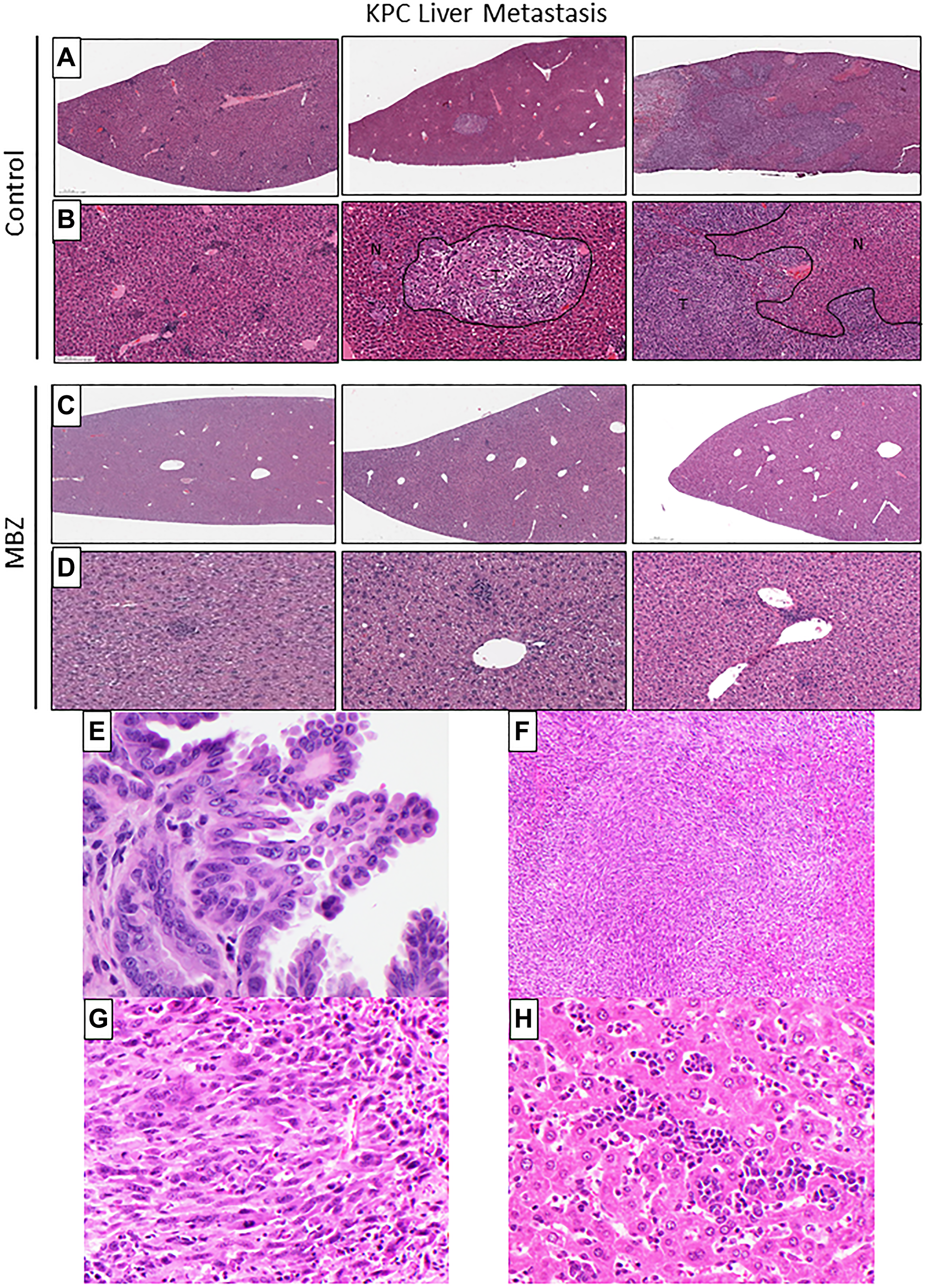 Mebendazole reduced the severity and incidence of liver metastasis in KPC mice when administered as an early intervention
