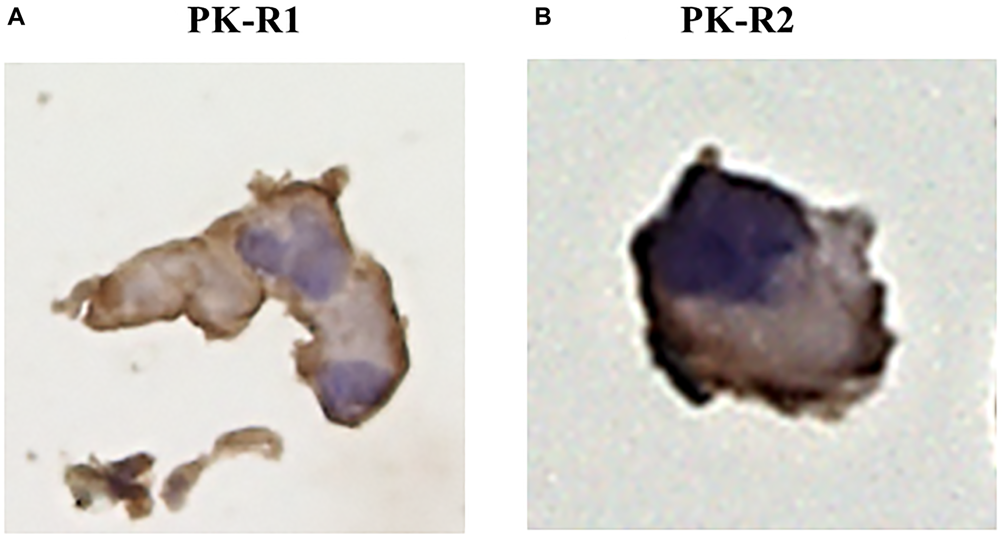 The expression of PK-R proteins in a human lymphatic endothelial cell line by immunohistochemical staining with anti- PK-R1 or PK-R2 mAb