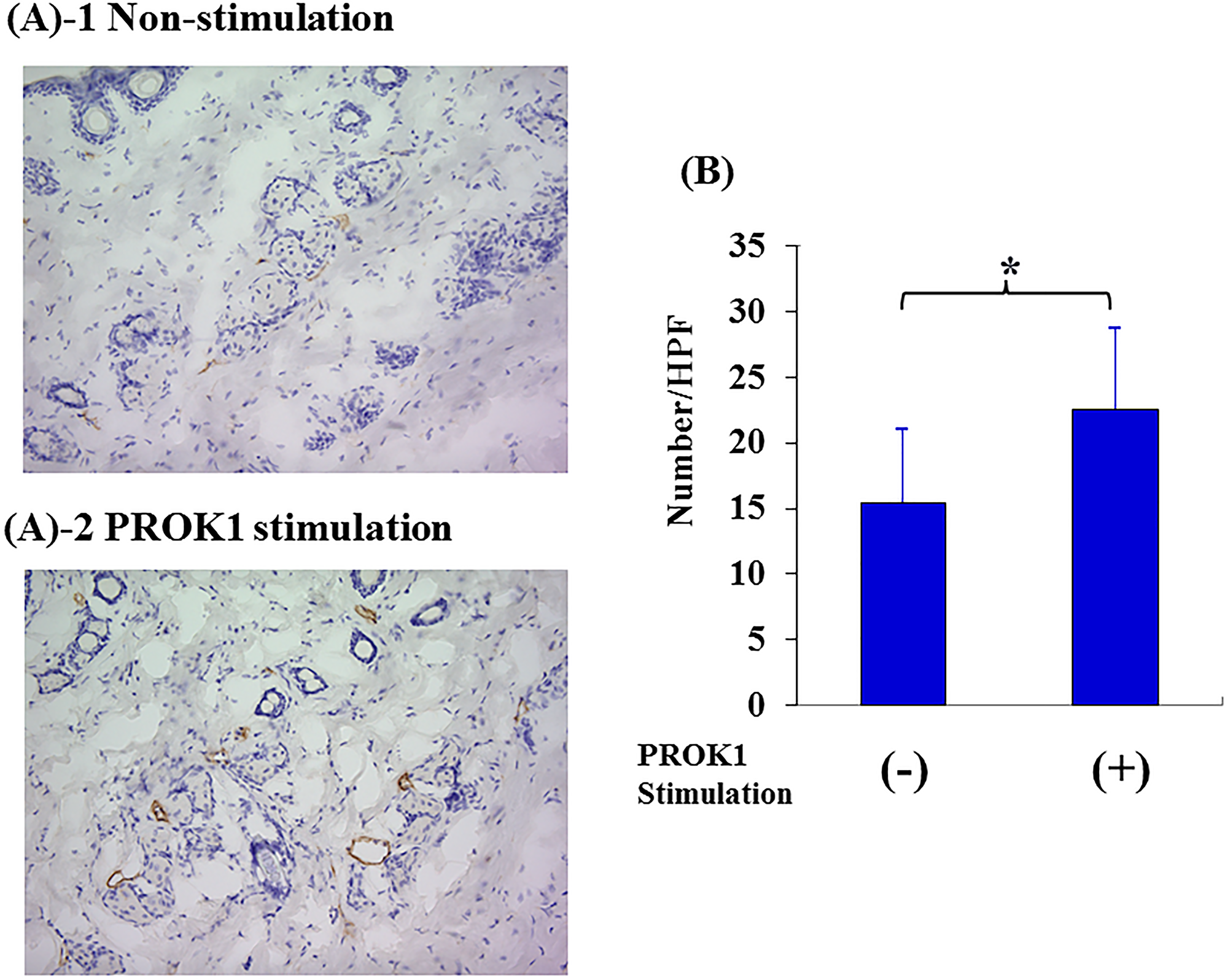 Investigation of Subcutaneous lymphangiogenesis by PROK1 protein