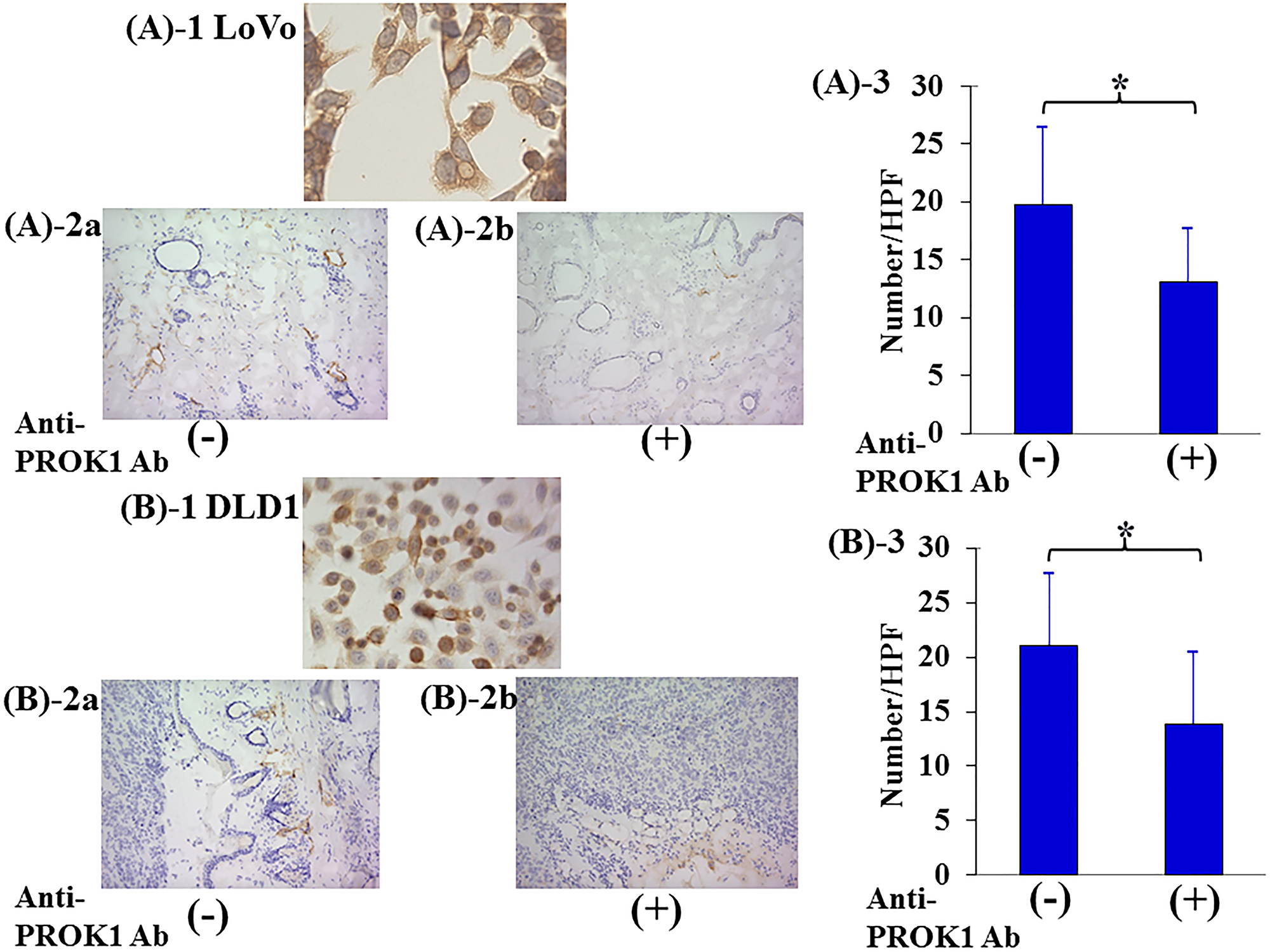 Investigation of Subcutaneous lymphagiogenesis by the anti-PROK1Ab