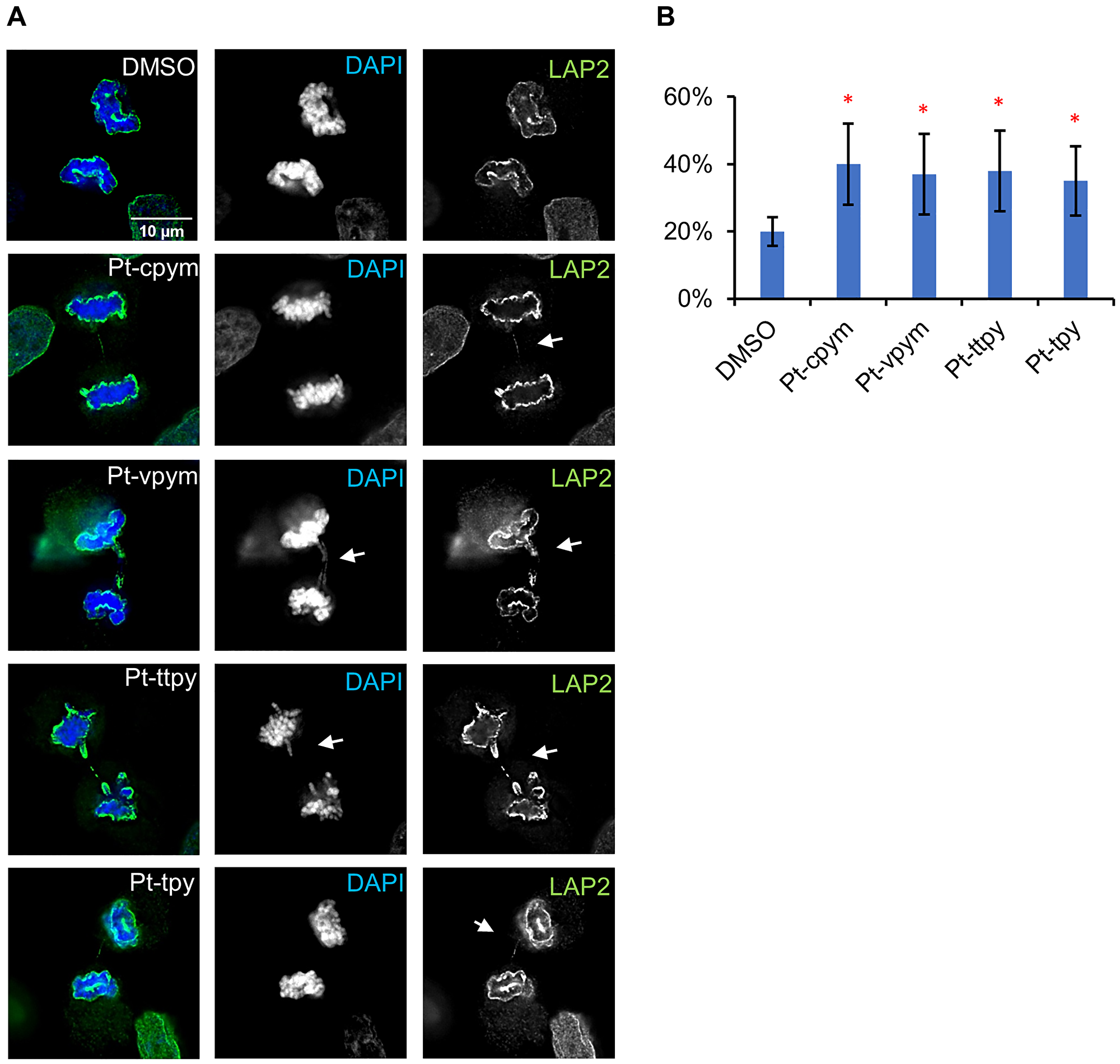 Chromatin bridge formation in HT1080 cells after treatment by Pt-tpy and its three derivatives, Pt-cpym, Pt-vpym and Pt-ttpy at telophase/cytokinesis