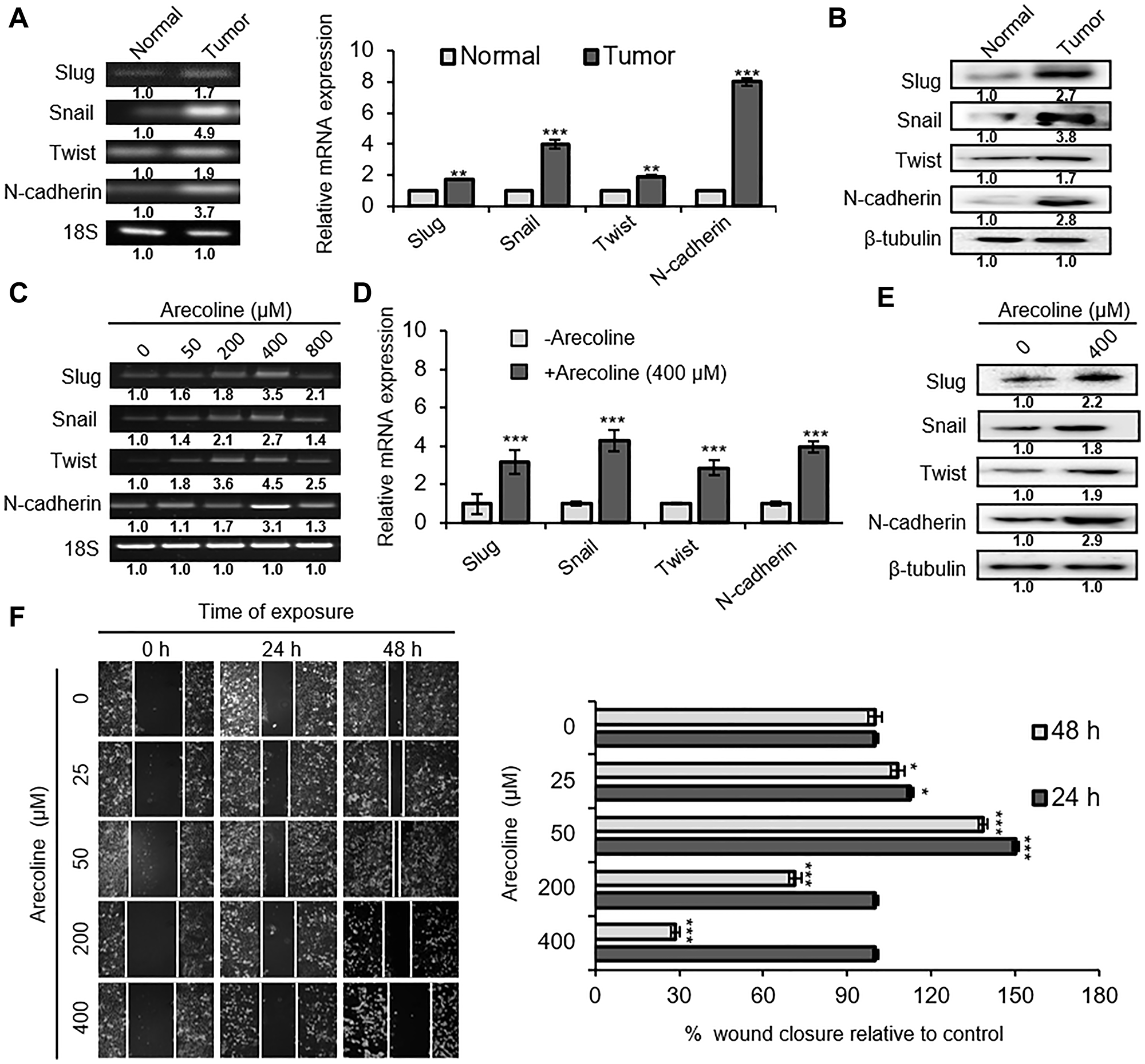 Arecoline induces EMT in a dose-dependent manner