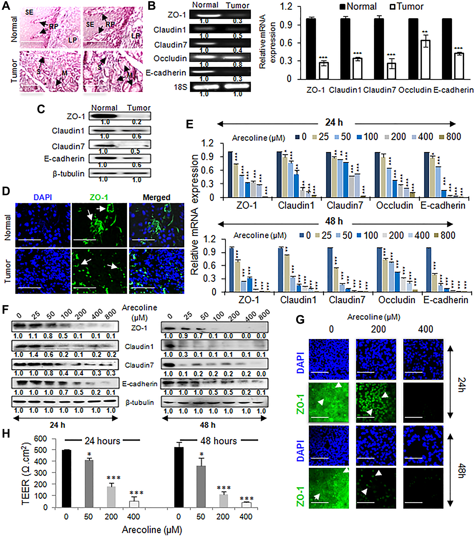 Arecoline disrupts tissue integrity and downregulates the expression of tight junction proteins in HNSCC