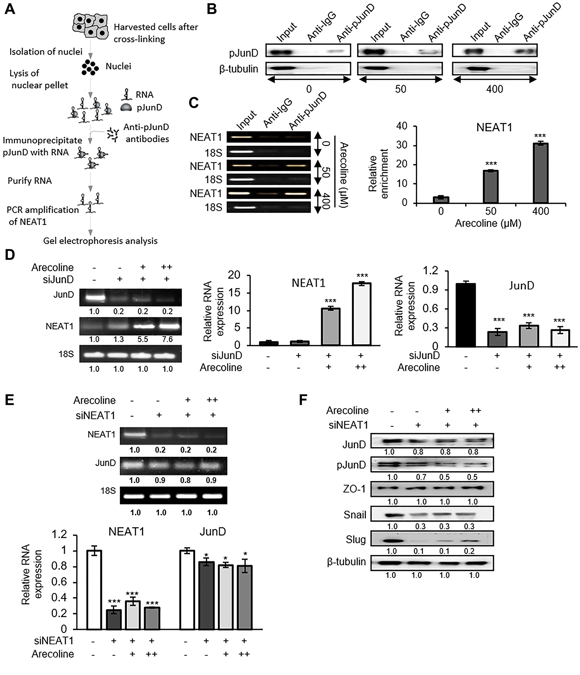 NEAT1 plays a pivotal role in JunD-mediated downregulation of ZO-1