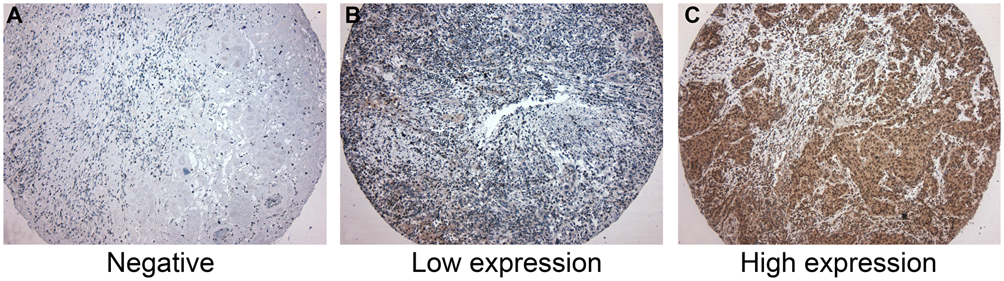 Immunohistochemistry for CD39