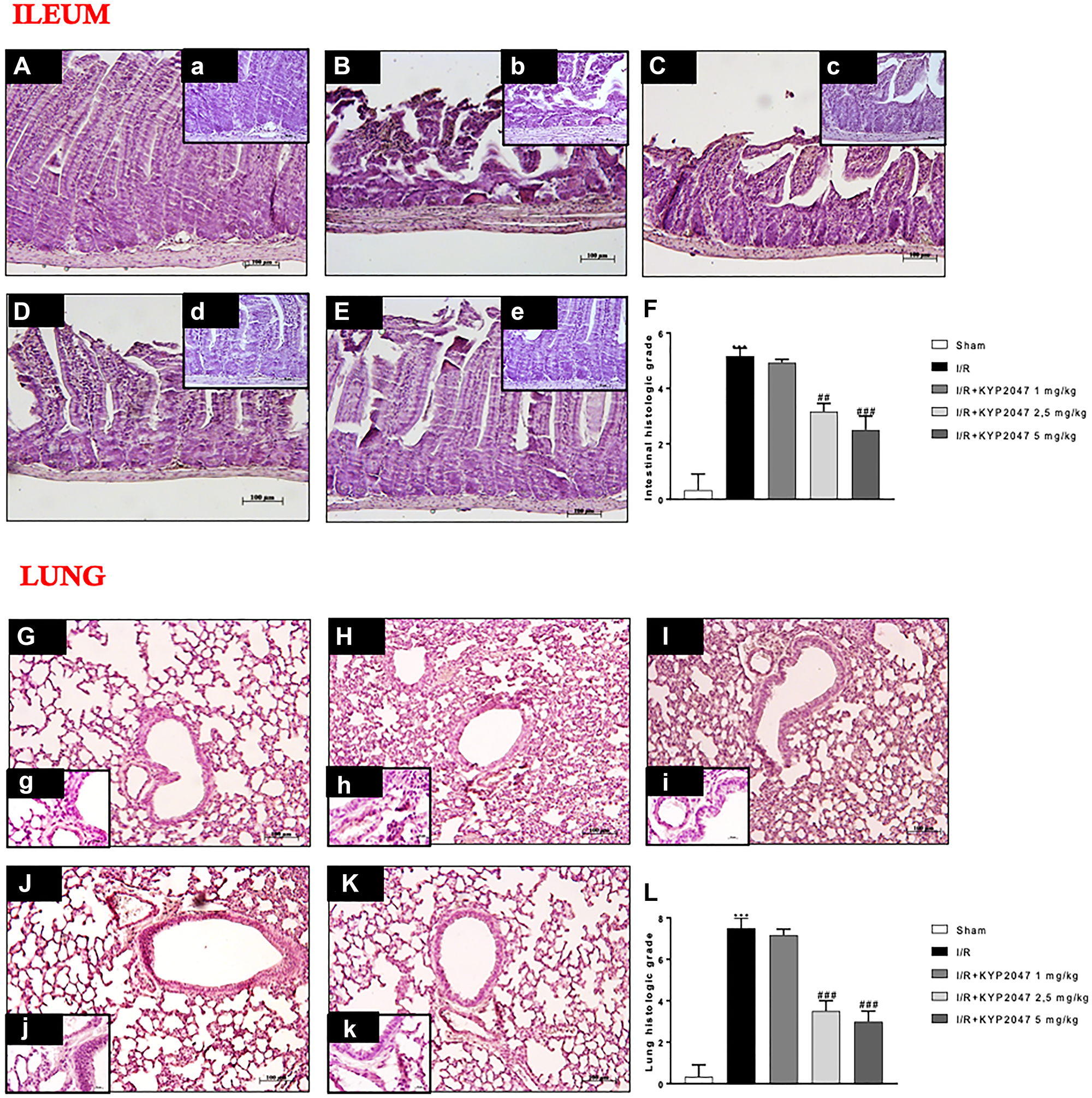 Role of KYP-2047 treatment on histological lung damage induced by II/R
