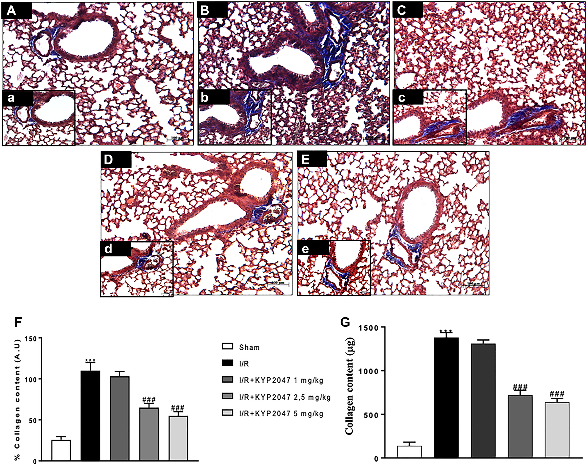 Role of KYP-2047 treatment on the collagen content