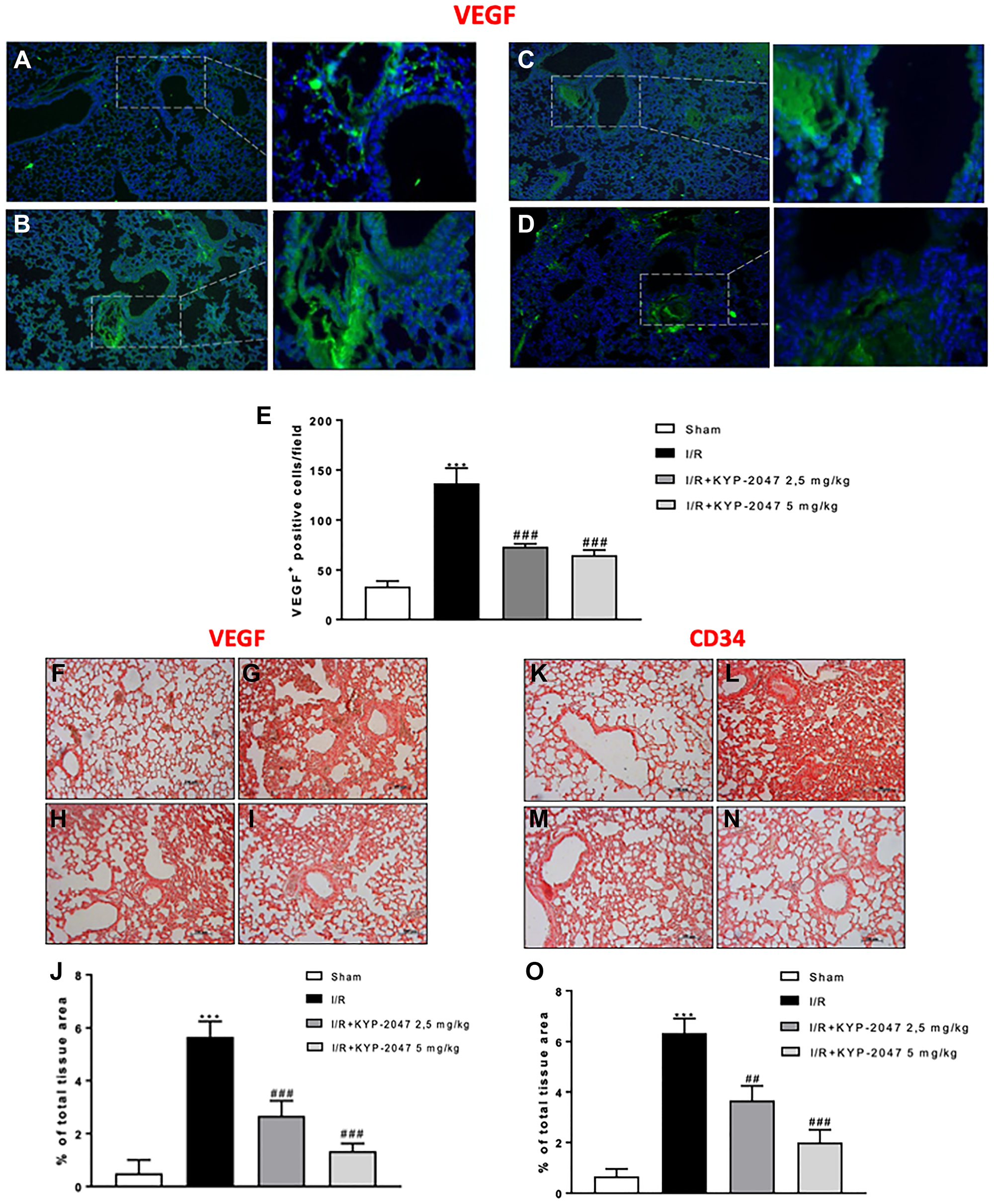 KYP-2047 treatment on angiogenesis