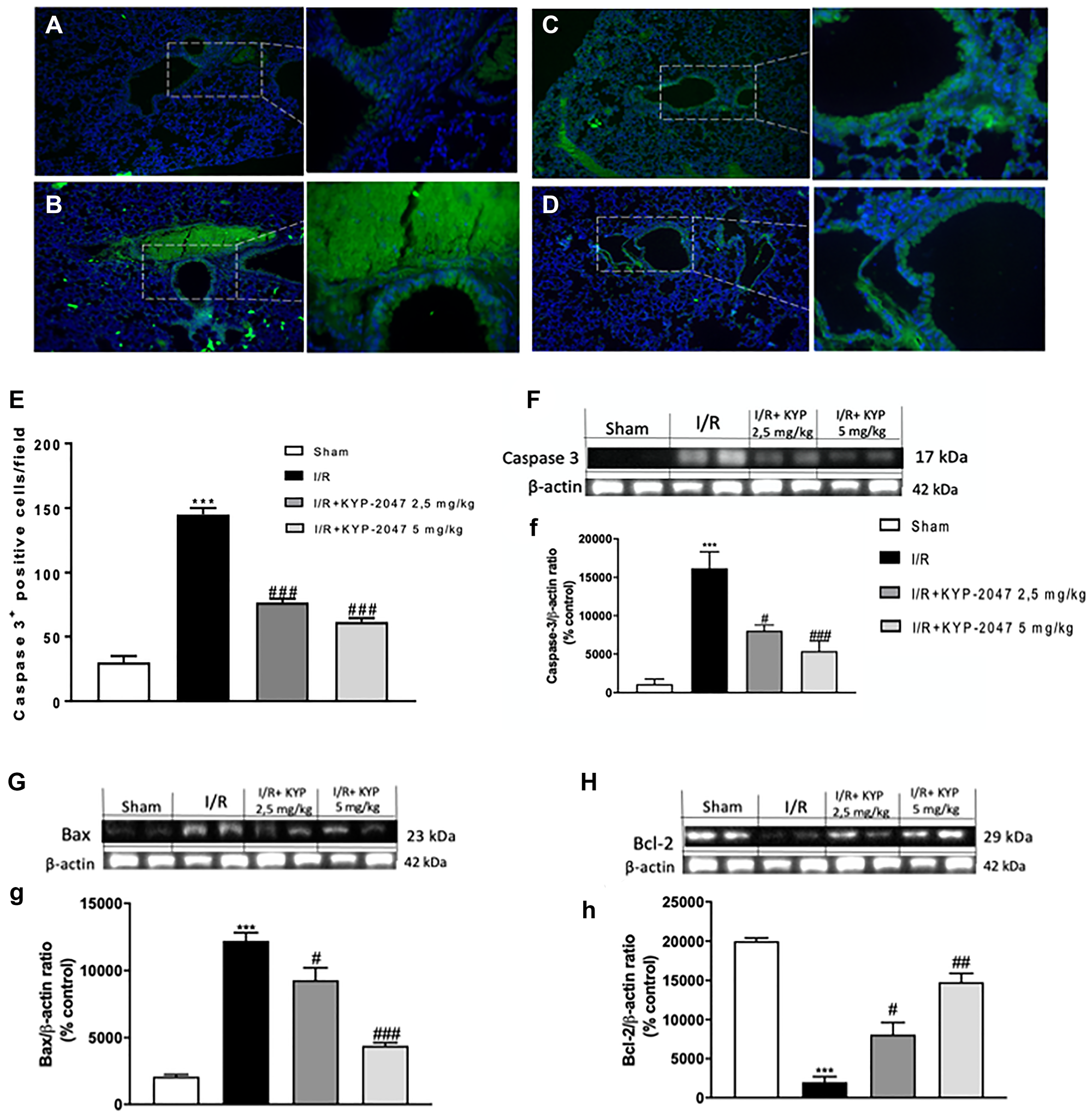 Role of KYP-2047 treatment on apoptosis