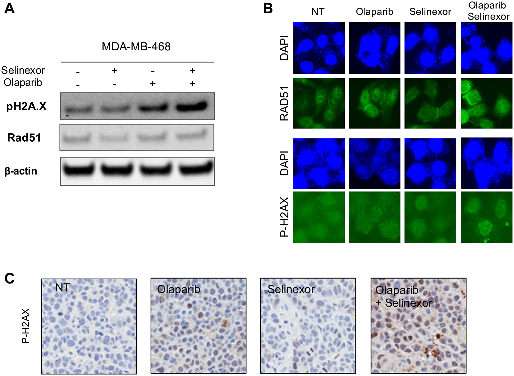 Effects of treatment with olaparib and selinexor (alone and in combination) on the homologous recombination pathway in MDA-MB-468 (BRCA1-wt TNBC cell)