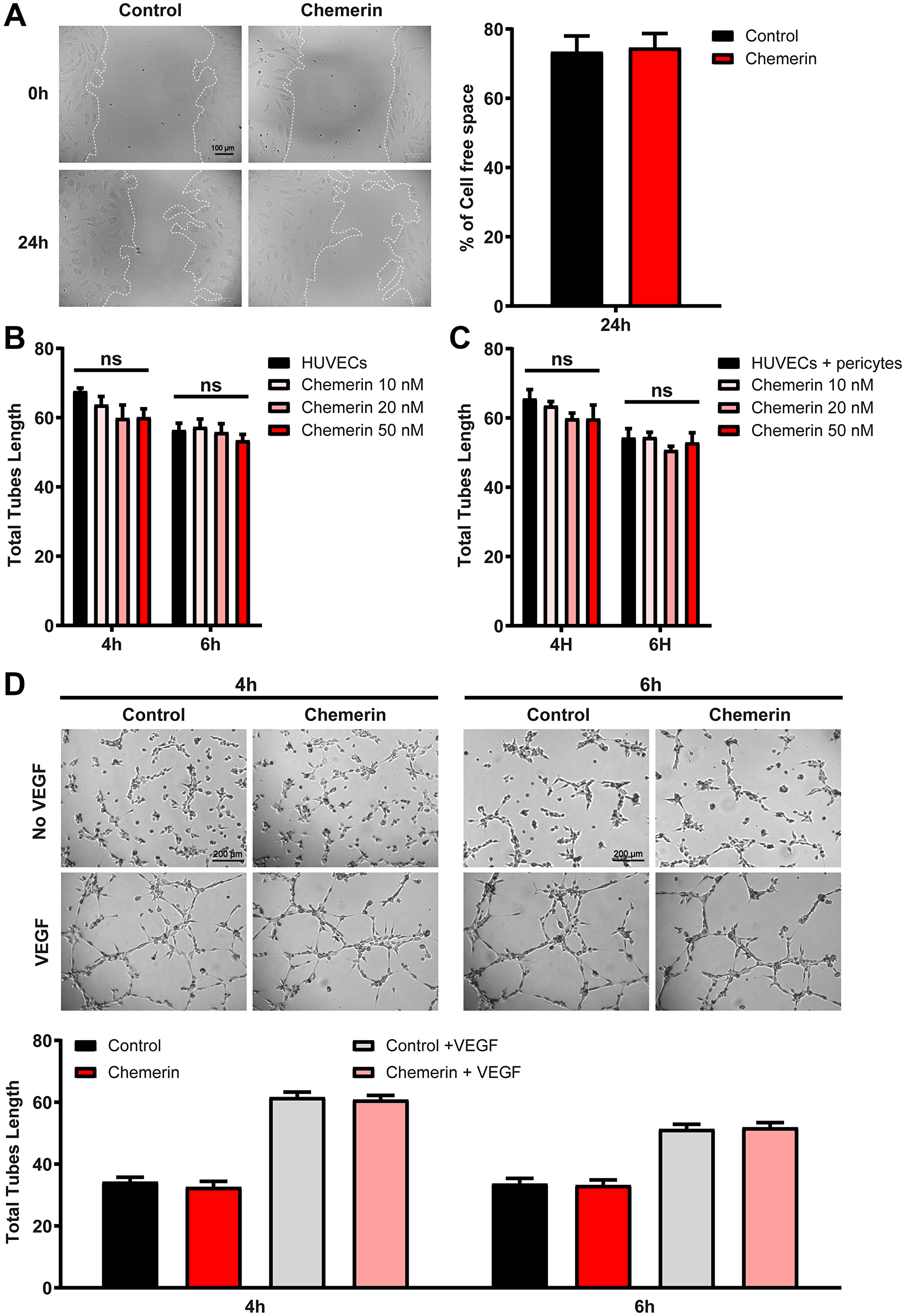 Effect of chemerin on ex vivo angiogenesis assays
