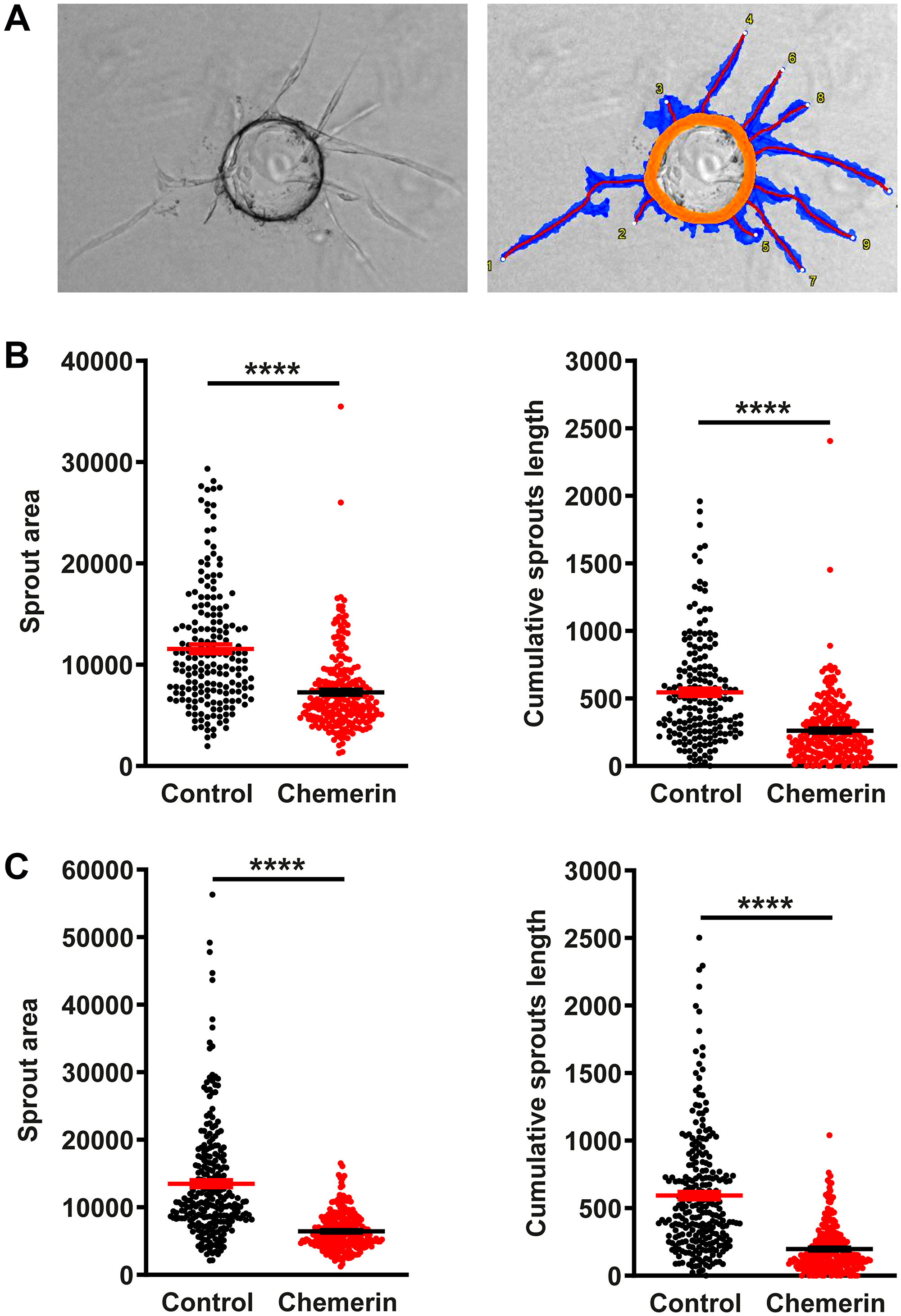 Chemerin inhibits angiogenesis in the bead sprouting assay