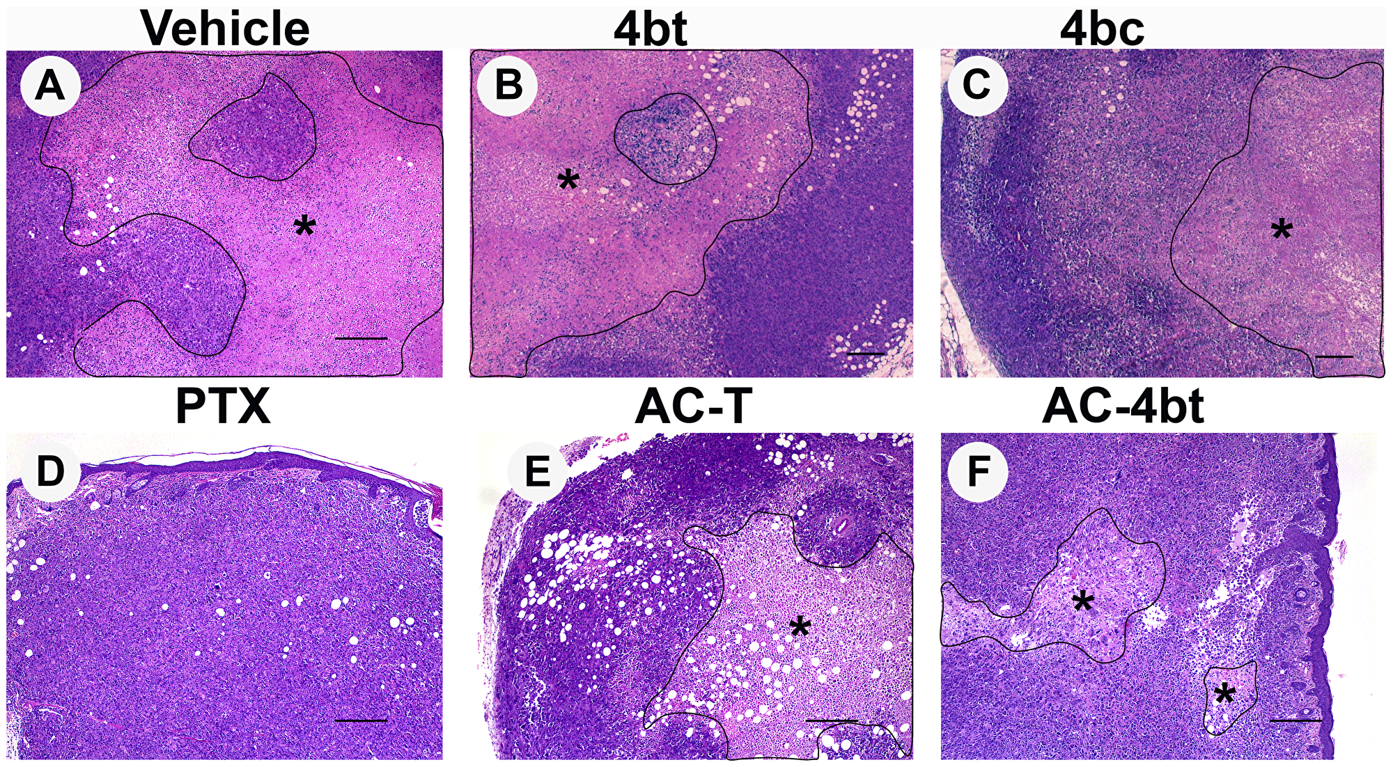 Histopathological analysis of tumor sections upon monotherapy or drug combination treatments