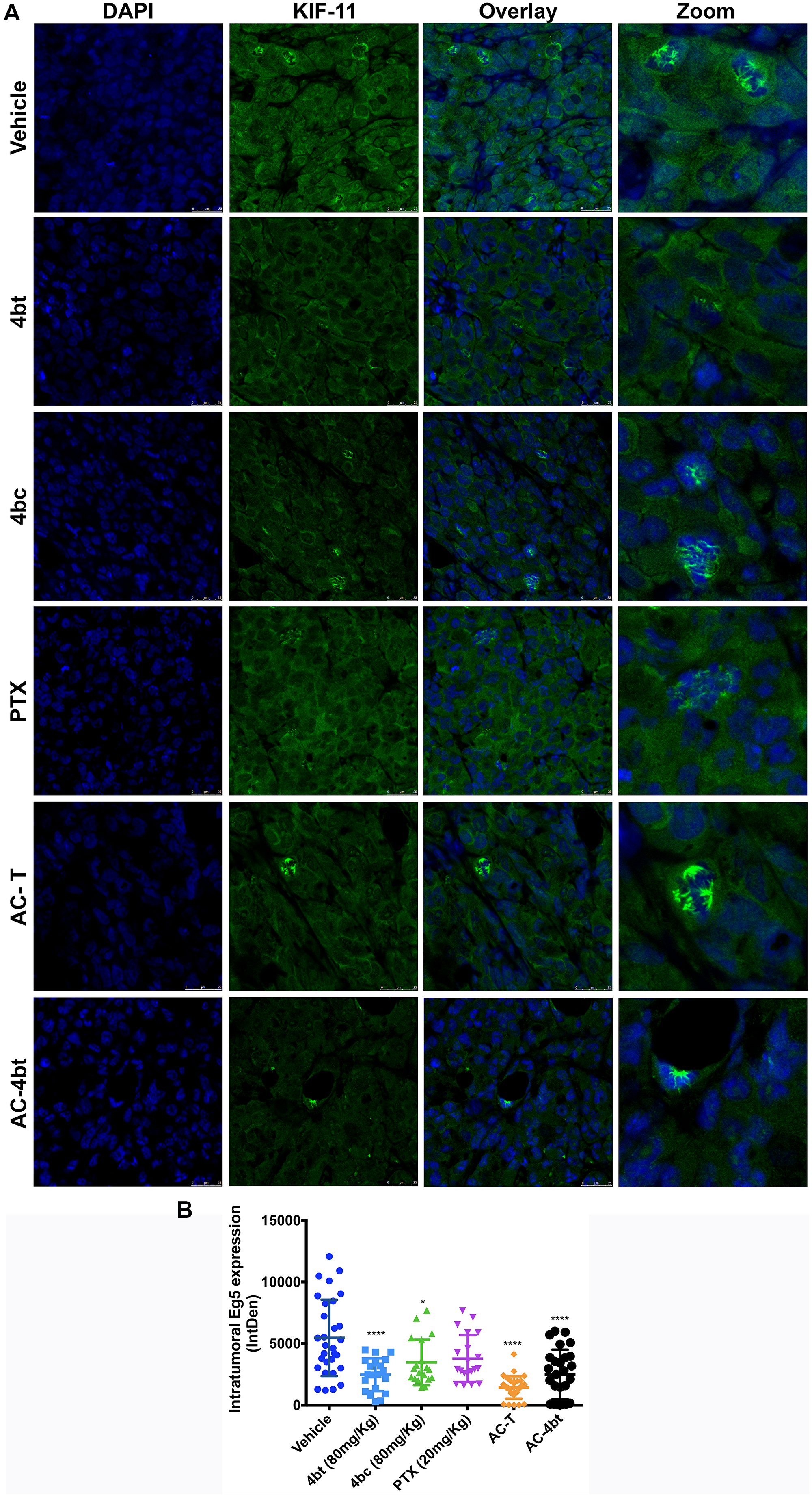 Analysis of intratumoral KIF11 expression