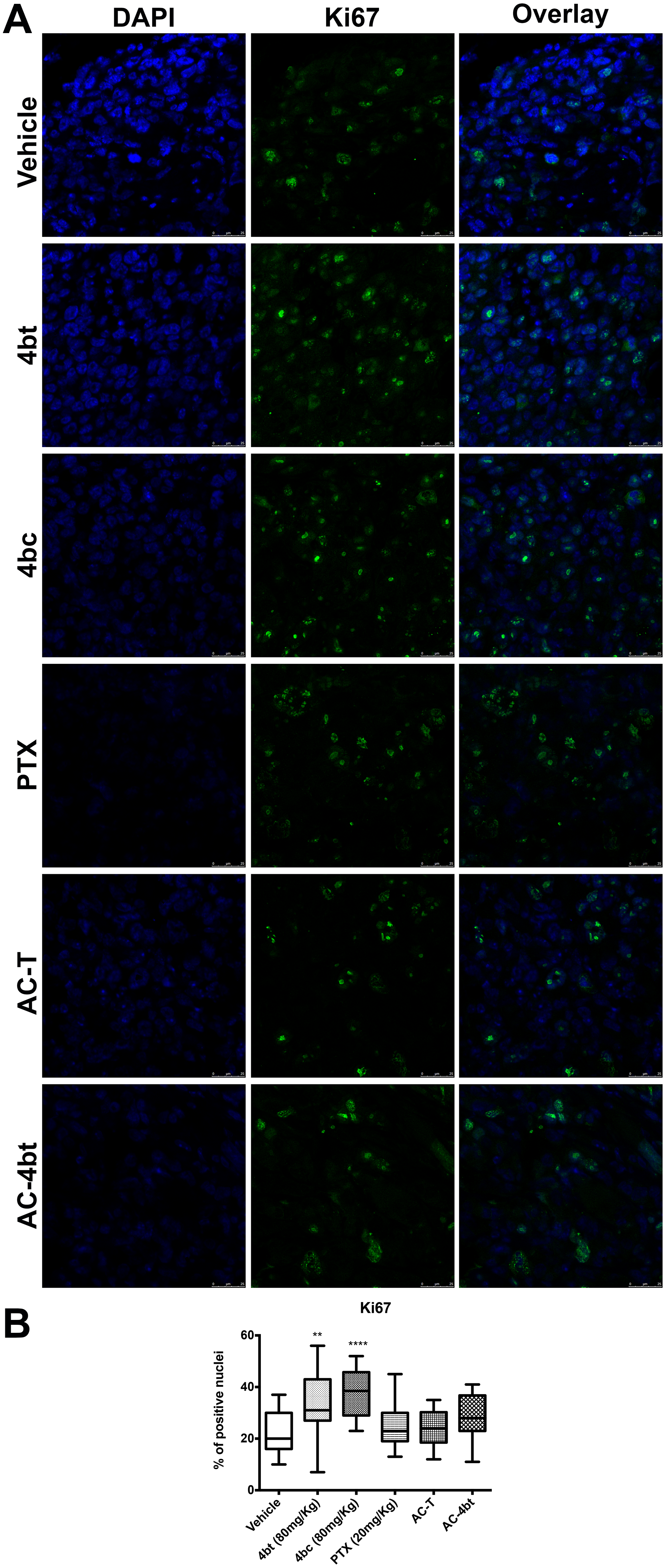 Proliferation analysis of tumor sections