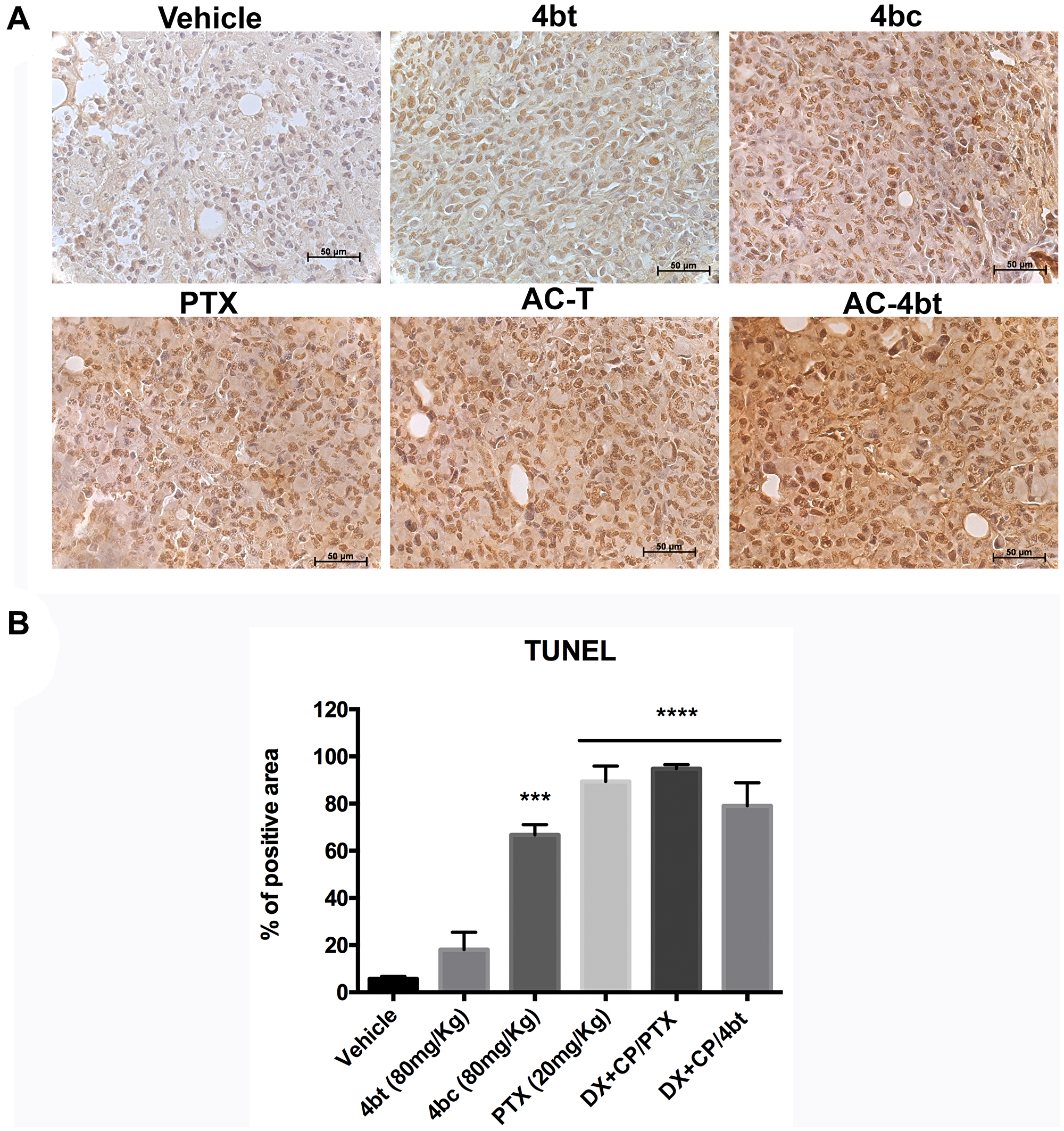 TUNEL analysis for apoptosis detection in tumor sections of xenografted Balb-c/nude mice