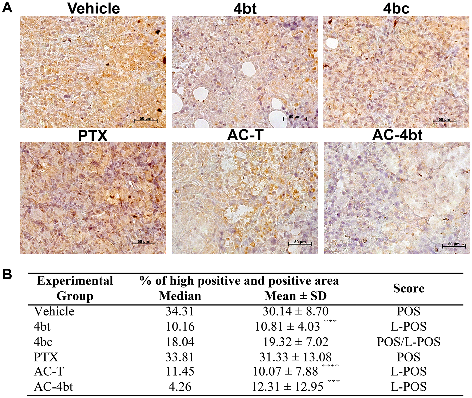 ALDH1-A1 expression analysis in tumor sections of xenografted Balb-c/nude mice