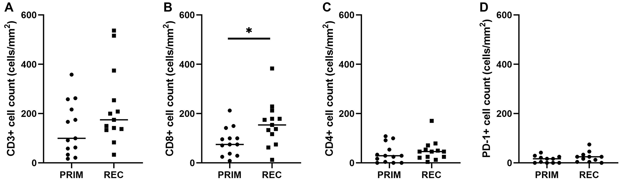 Quantitative TIL scores in primary and recurrent glioblastoma