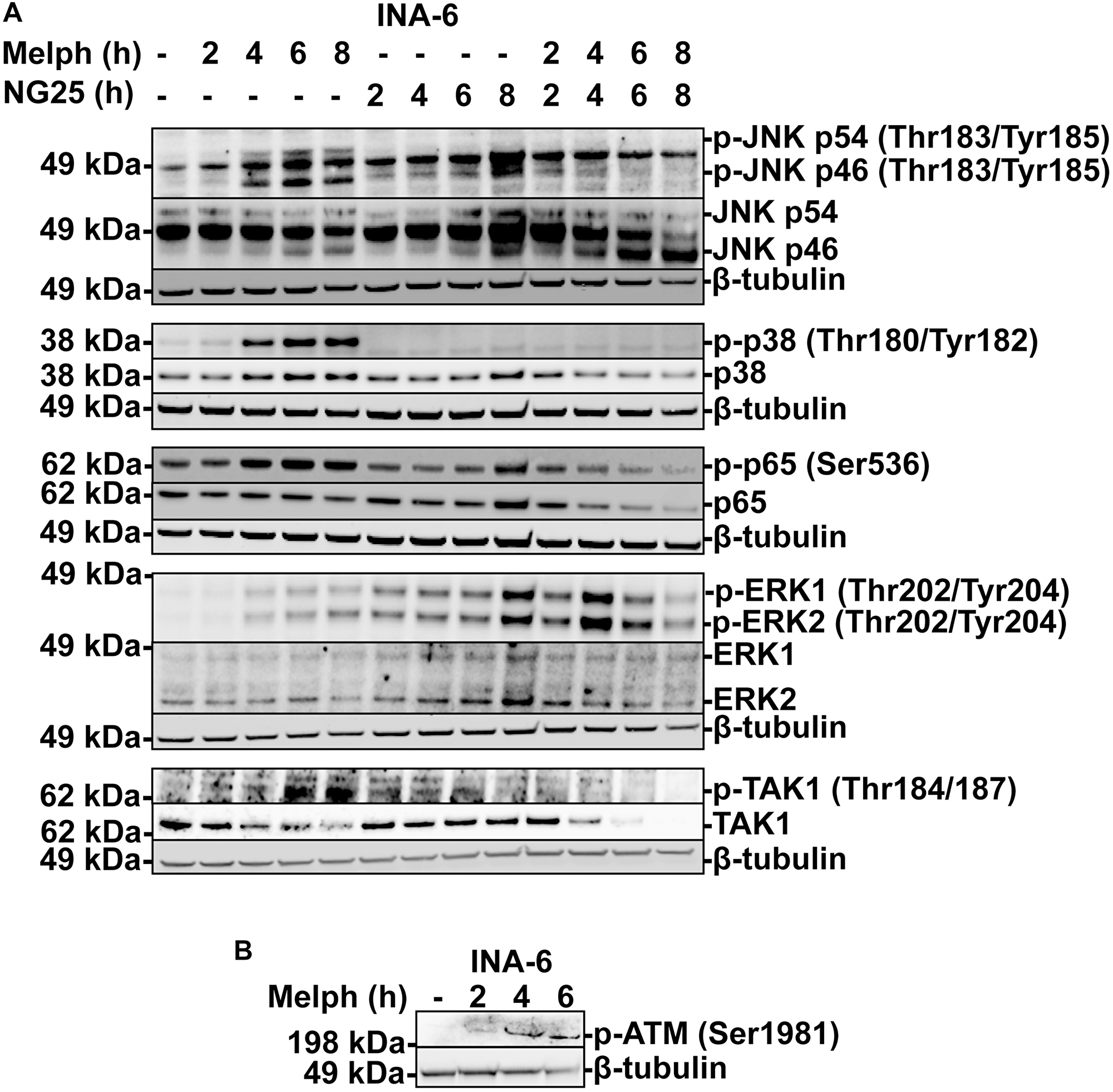 NG25 blocks melphalan-induced p38, ERK- and NF-κB signaling