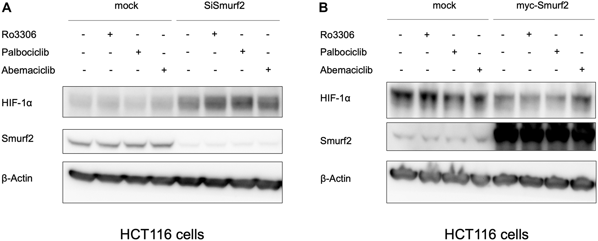 Smurf2 regulates HIF-1α expression in HCT116 colon cancer cells