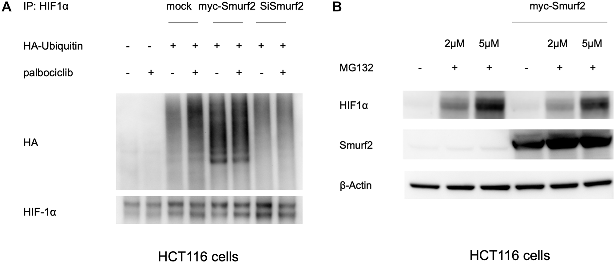Smurf2 enhances HIF1α ubiquitination in normoxia