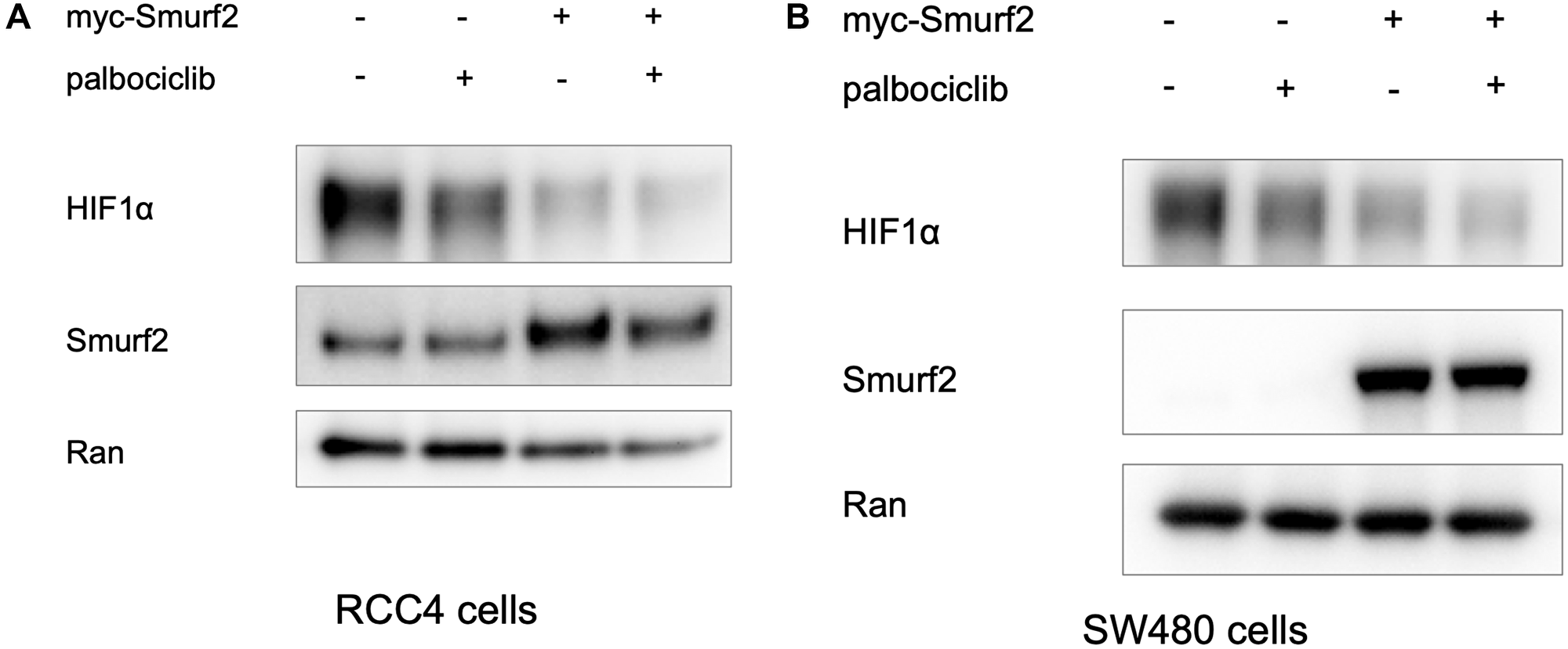 Overexpression of Smurf2 reduces HIF-1α expression level in RCC4 cells under normoxia and in SW480 cells under hypoxia