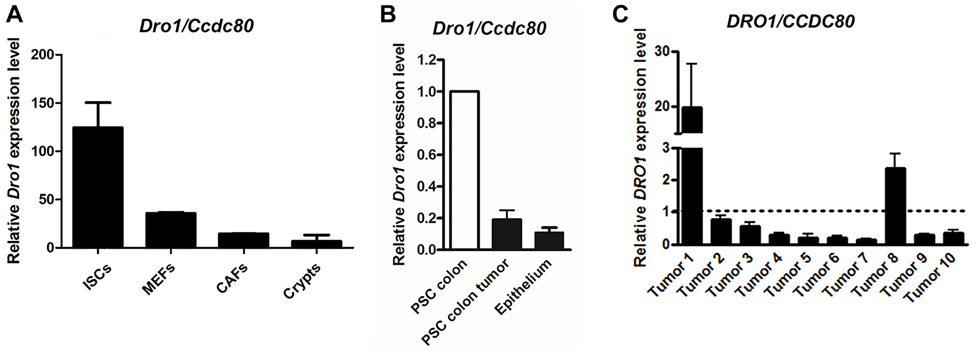 DRO1/CCDC80 is down-regulated in the stromal tumor compartment