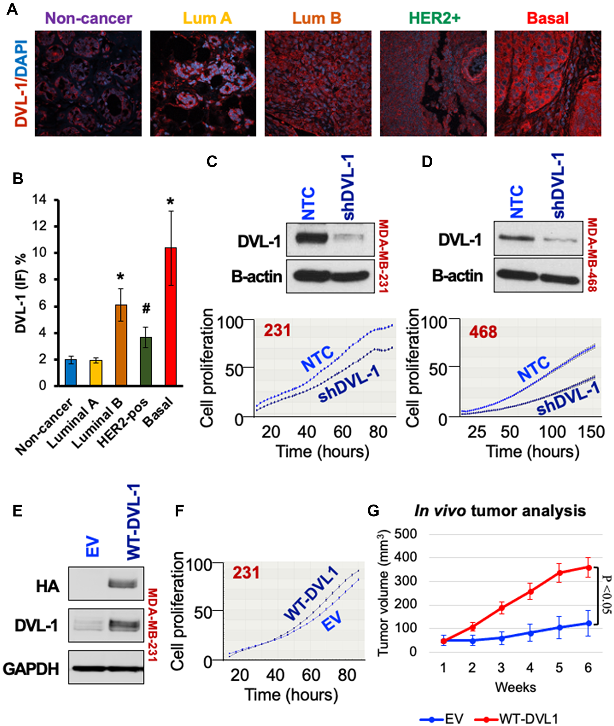 High DVL-1 expression promotes cell proliferation and xenograft tumor growth in triple-negative breast cancer
