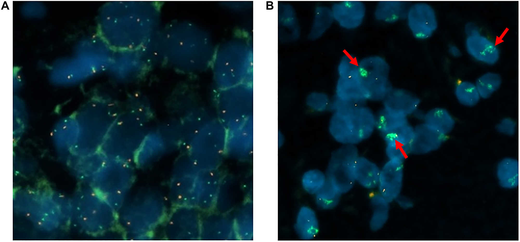Representation of individual tumor cell nuclei (MET/CEN7 probe and DAPI)