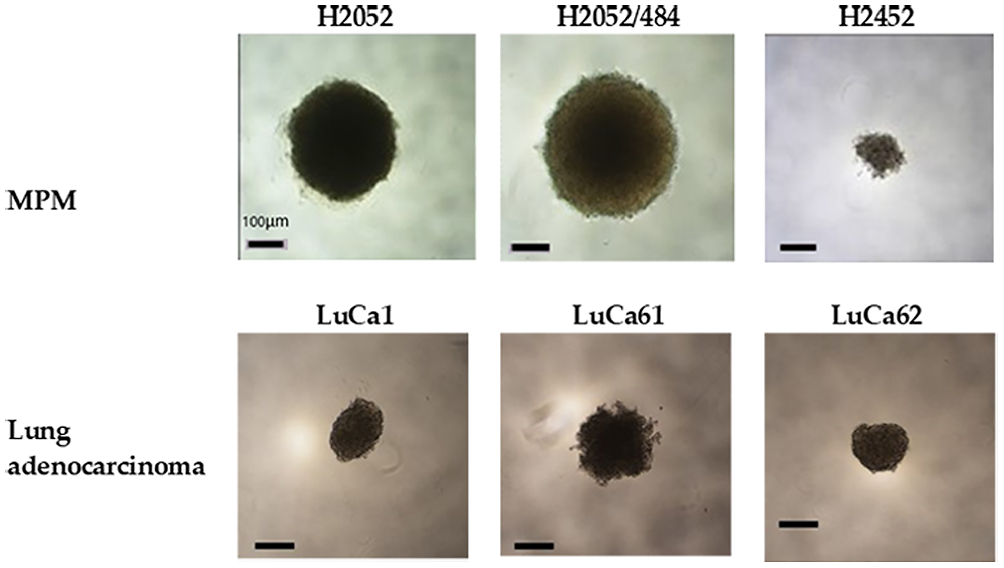 Multicellular spheroids were generated from MPM and lung adenocarcinoma cell populations