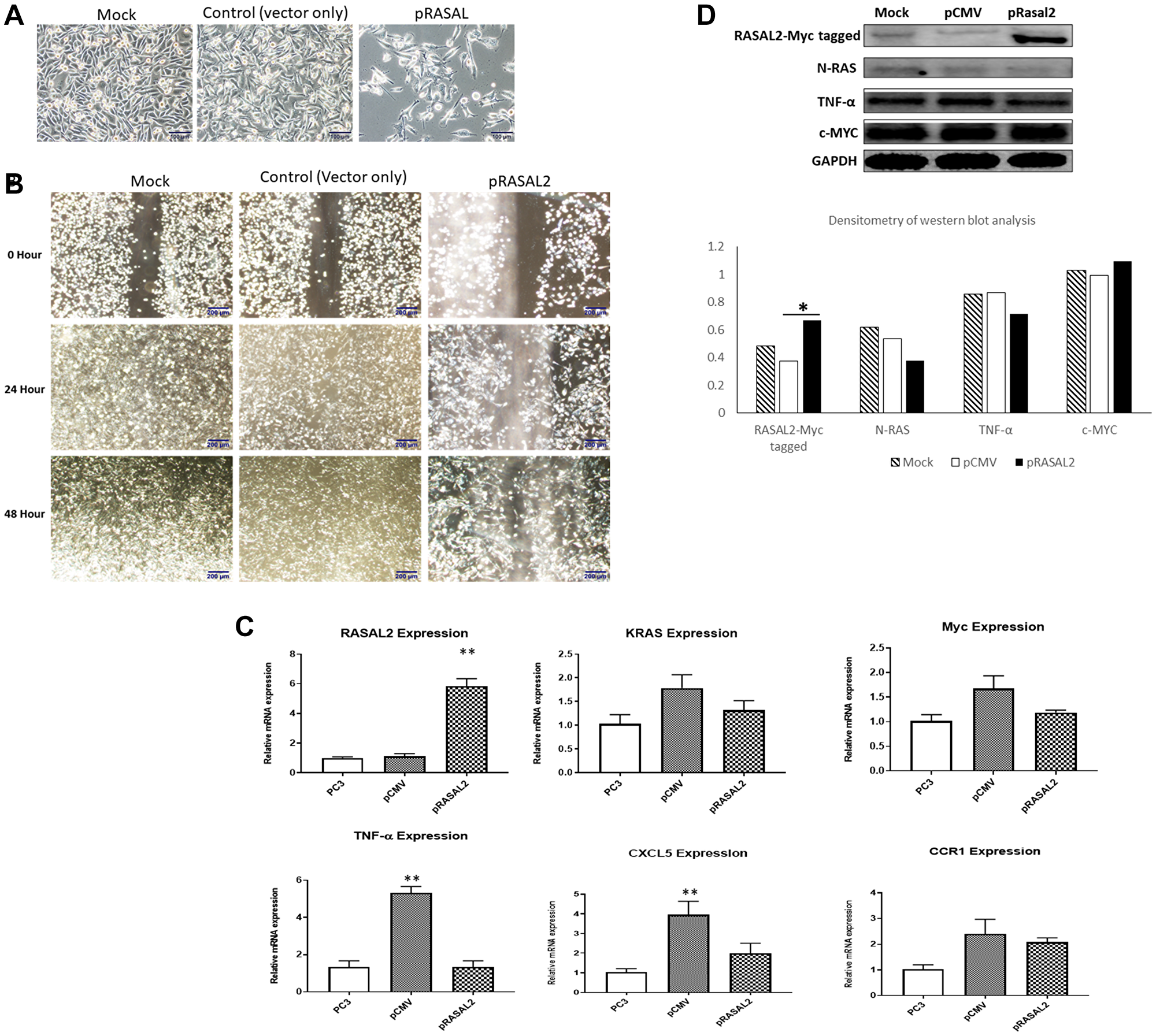 (A) Cell growth and morphology of stably transfected PC3 with RASAL2 vector or empty vector compared to untransfected cells. (B) Wounding assay of scatter/migration. PC3 cells stably transfected with RASAL2 plasmid or vector only were used in a scratch wound assay as described in Materials and Methods. The cells were permitted to migrate to the area of clearing for a total of 48 hrs and photomicrographs taken at 0, 24 and 48 hrs. Results shown are typical of 3 separate experiments. (C) qRT-PCR of RASAL2 expression in stably transfected cells (D) Western blot analysis of PC3 cells stably transfected with RASAL2 vector or empty vector only. Densitometry of western blot analysis is shown as the ratio of each protein expression to GAPDH protein. Statistical significance is indicated as *(p $!--ESC