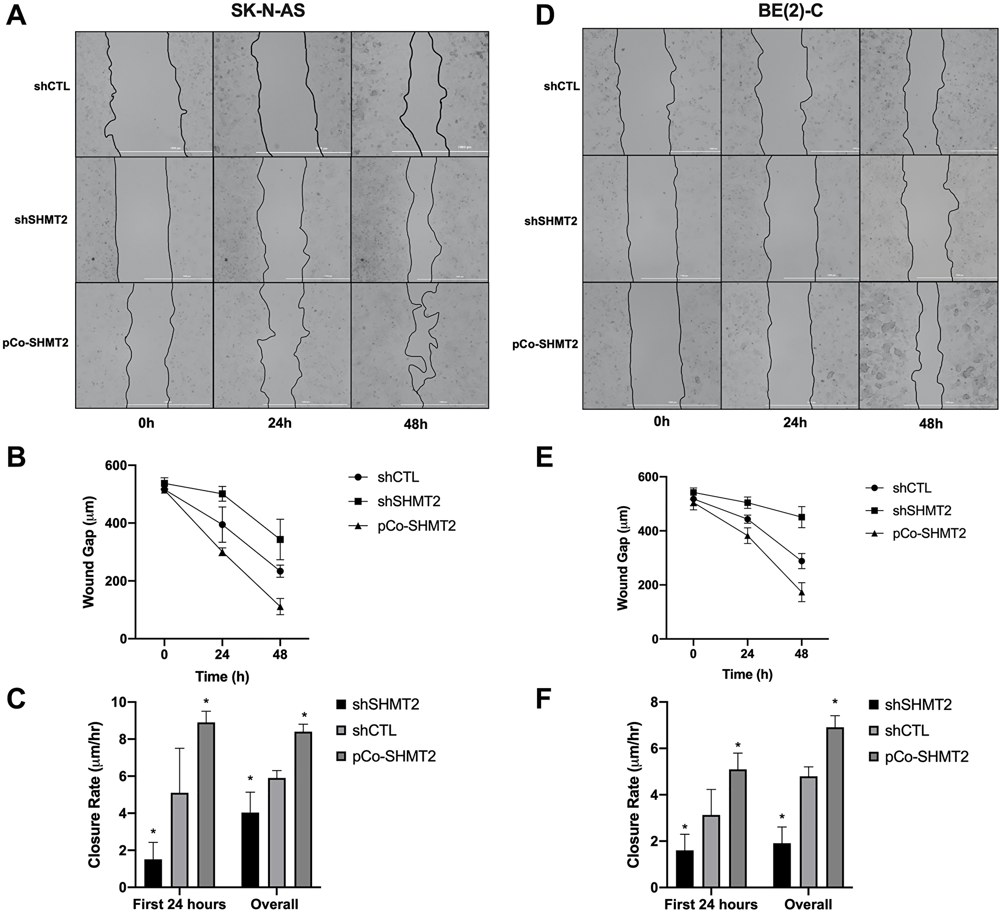 SHMT2 silencing impairs cellular migration in NB