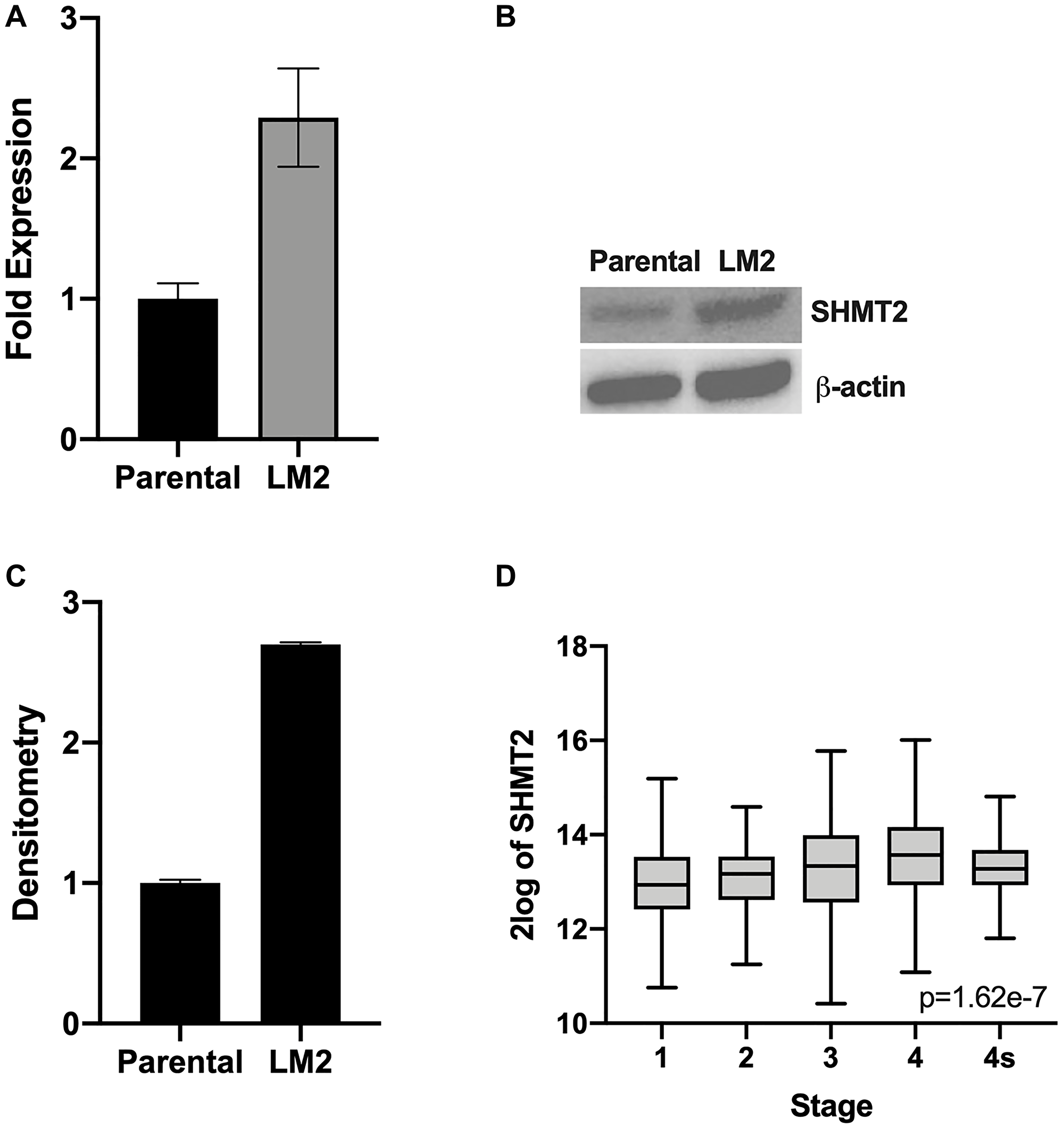 SHMT2 expression is increased in metastatic NB cells