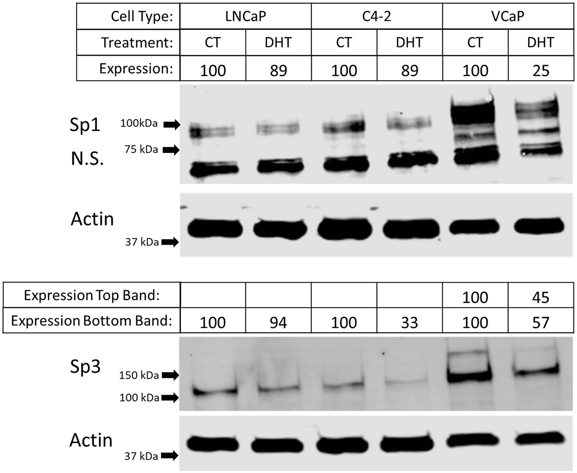 Differential protein expression of Sp1 and Sp3 after androgen treatment in different prostate cancer cell lines