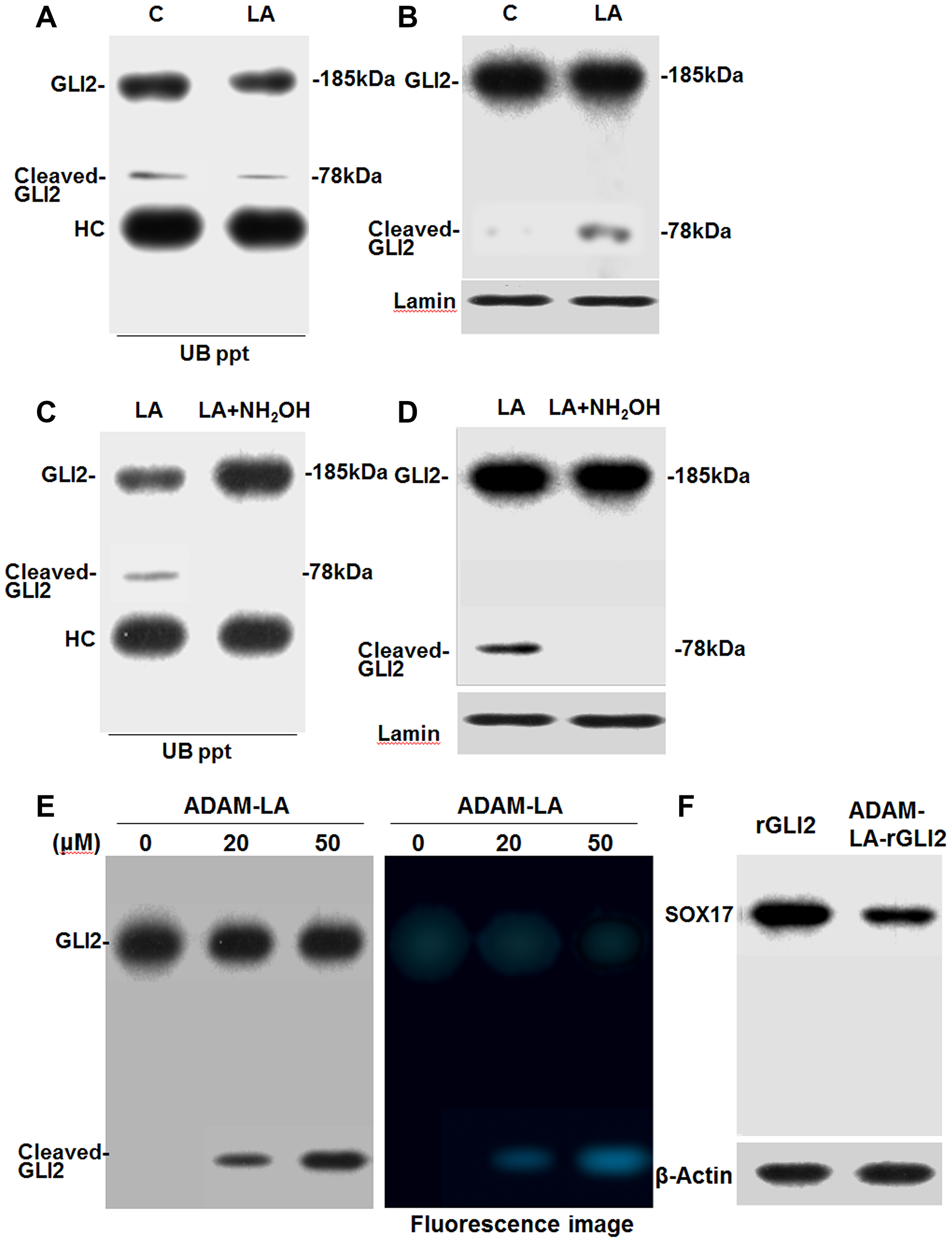 Effect of LA on the ubiquitination of GLI2 in CT26 cells