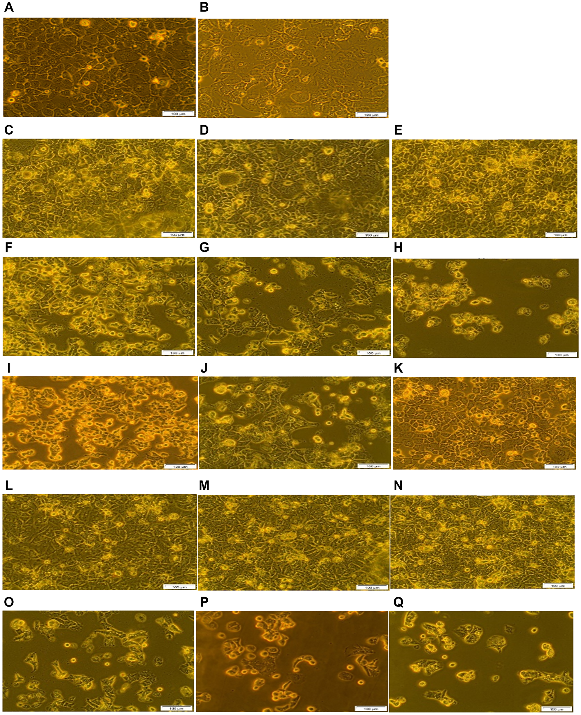 Morphological analysis of the FNBC PDT response assays with and without CBD treatment