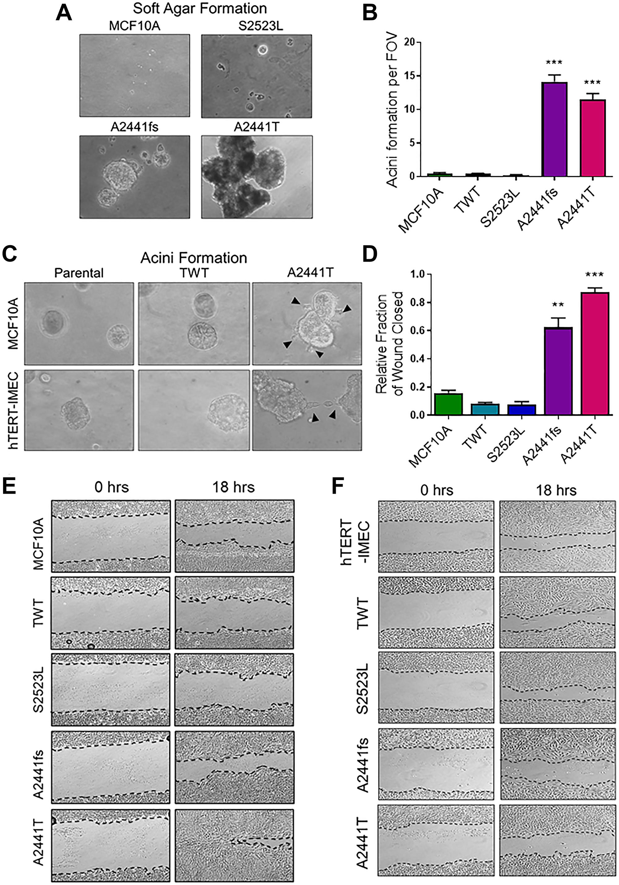 EGF-independent NOTCH1 variants demonstrate increased transformative phenotypes