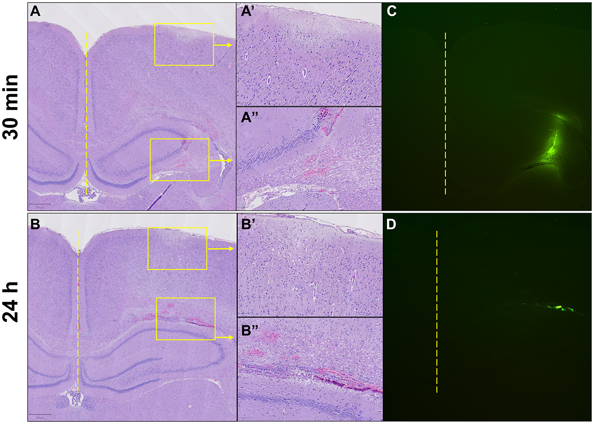 Acute intracranial cellular response to ECM-SF and retention of FITC-dextran-spiked ECM-SF after direct intracranial injection