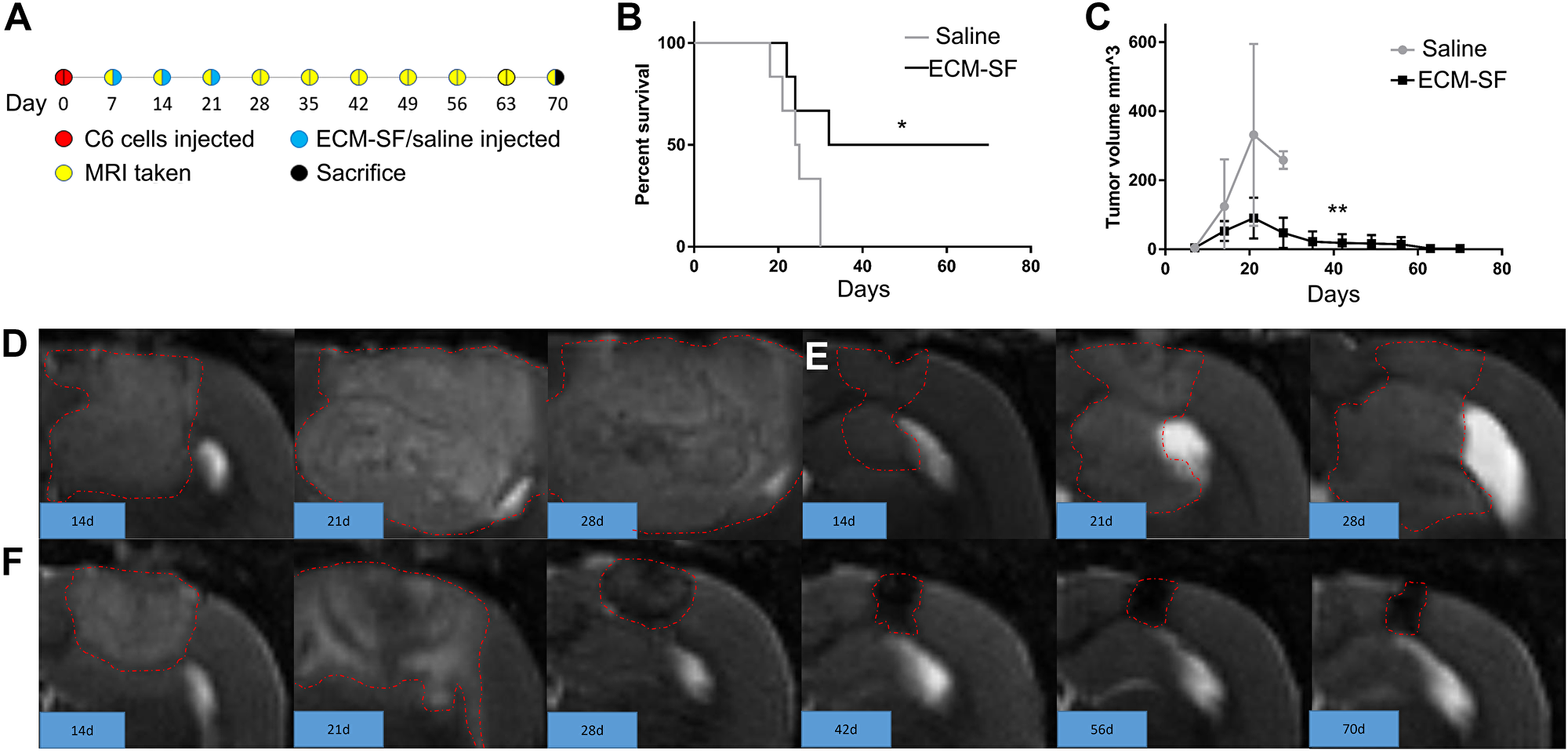 Pre-clinical model of treatment of glioblastoma with ECM-SF